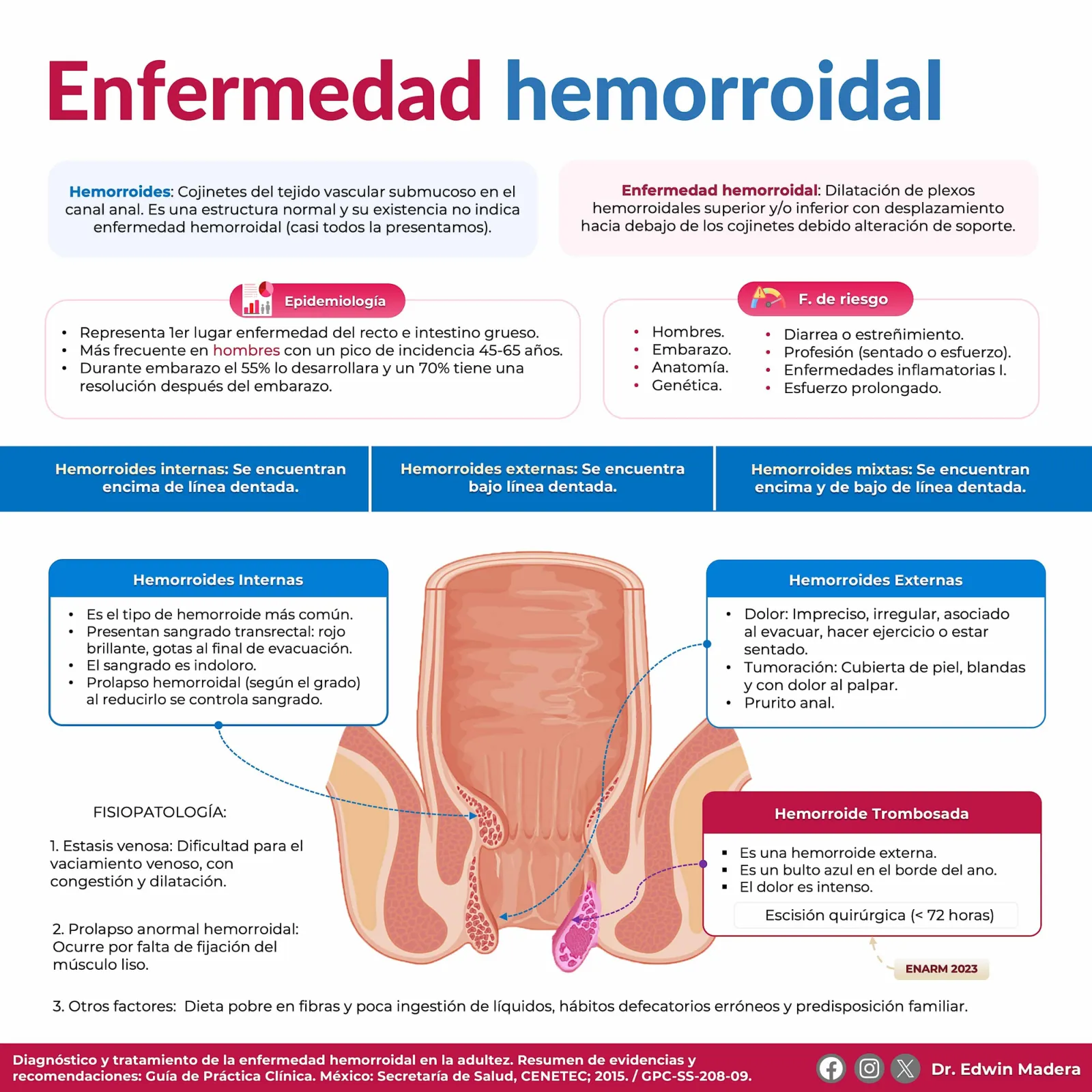 Enfermedad hemorroidal