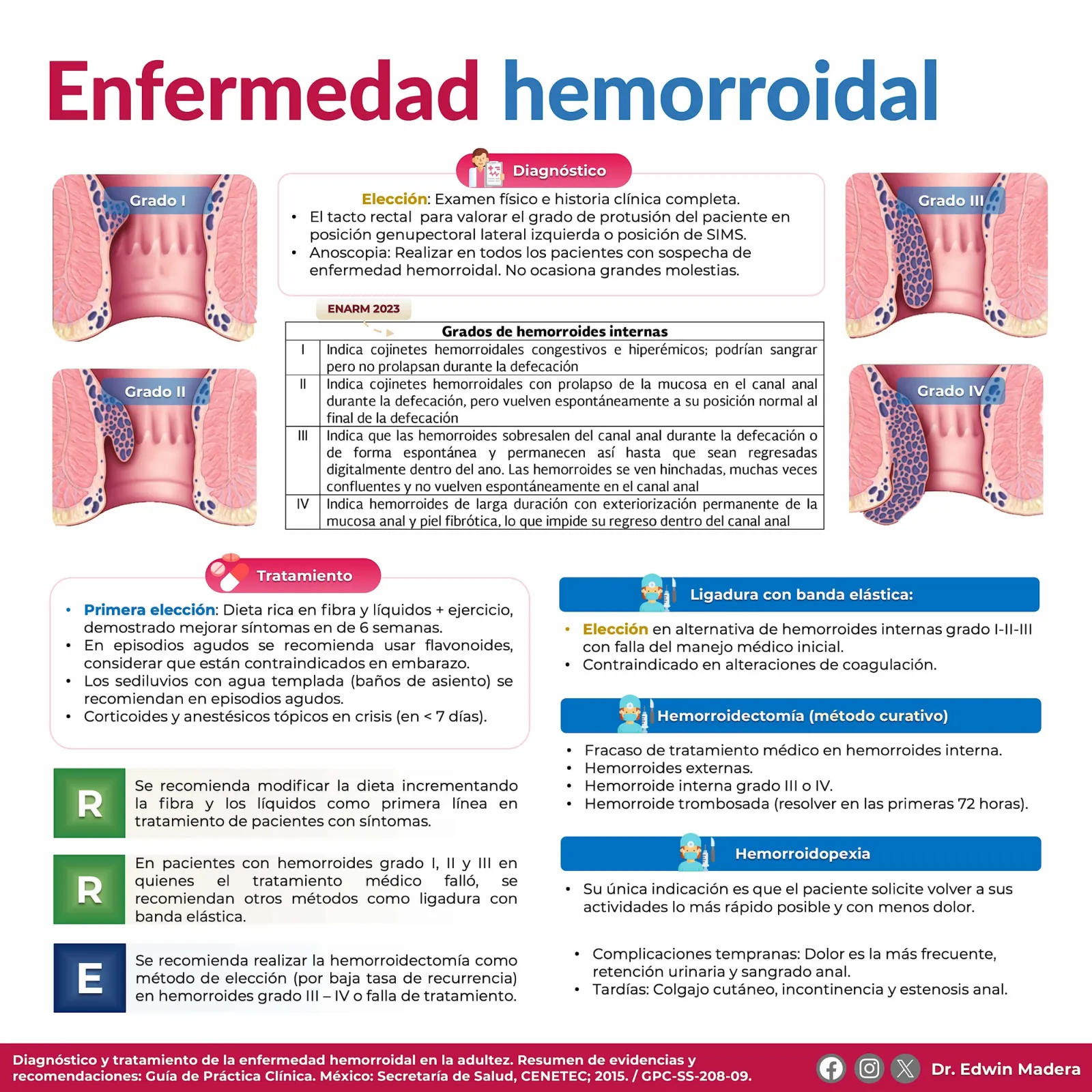 Enfermedad hemorroidal