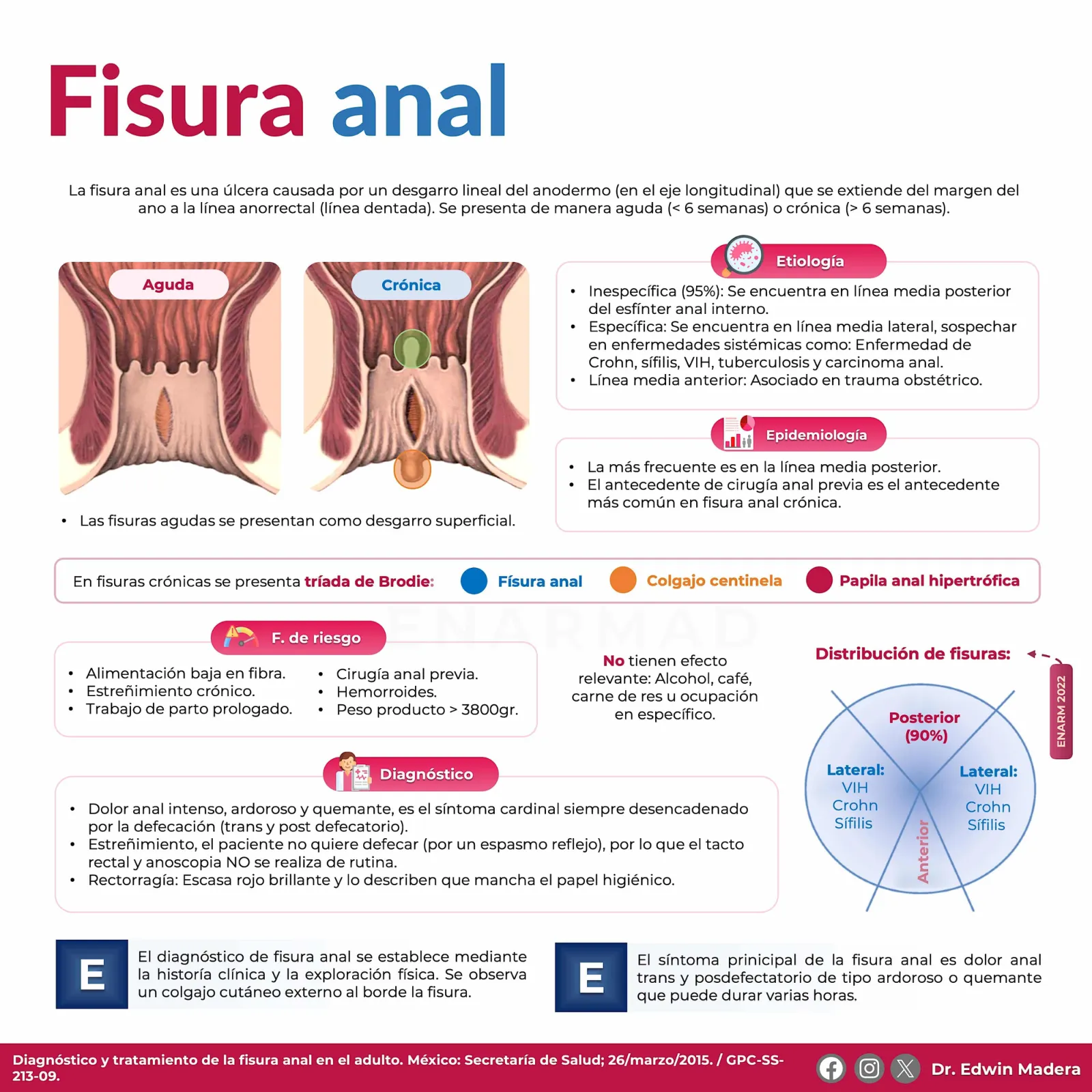 Fisura anal