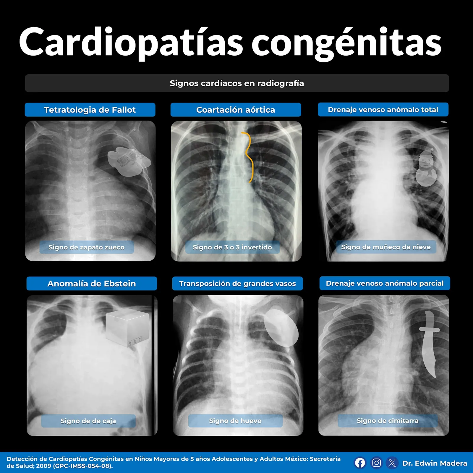 Cardiopatías congénitas