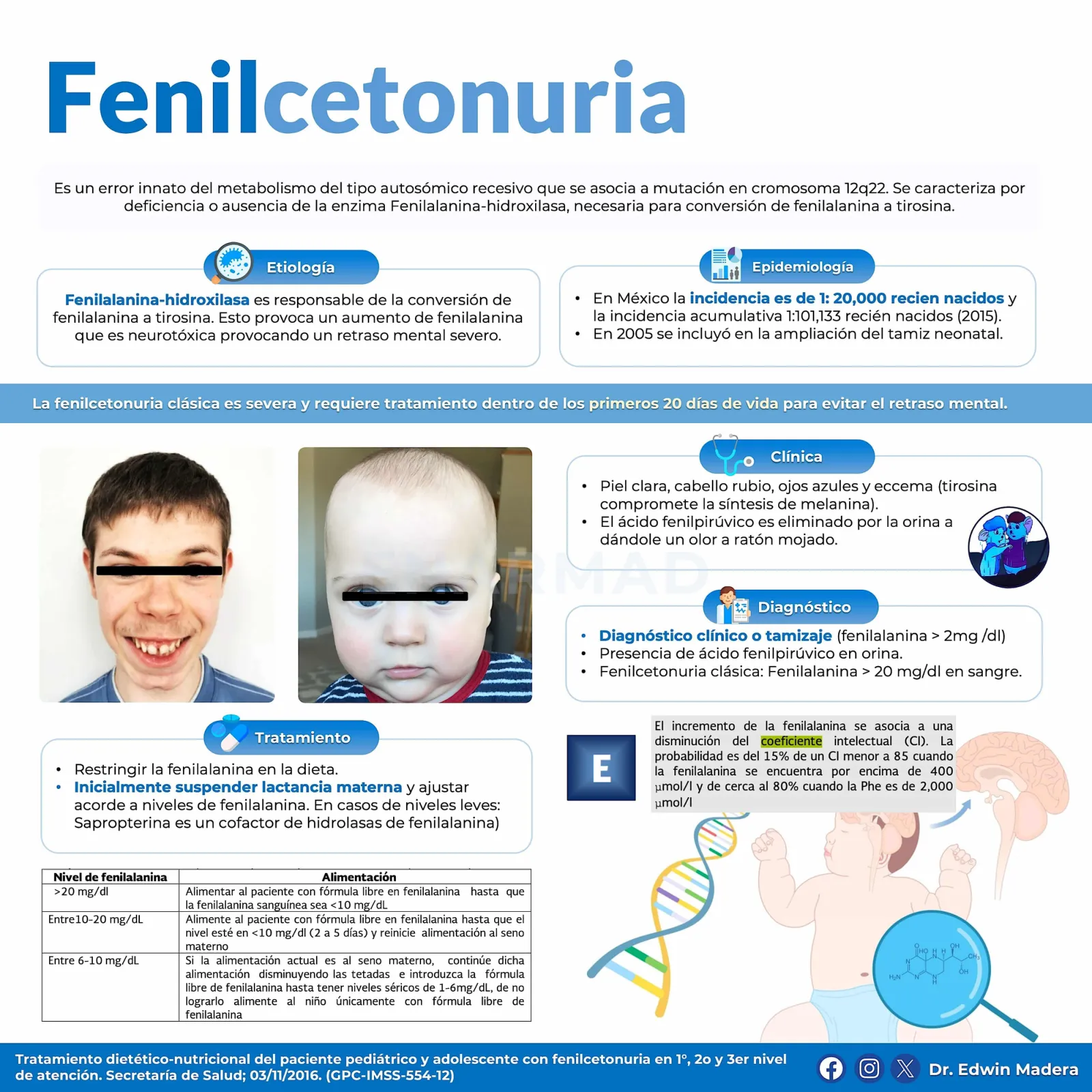 Fenilcetonuria