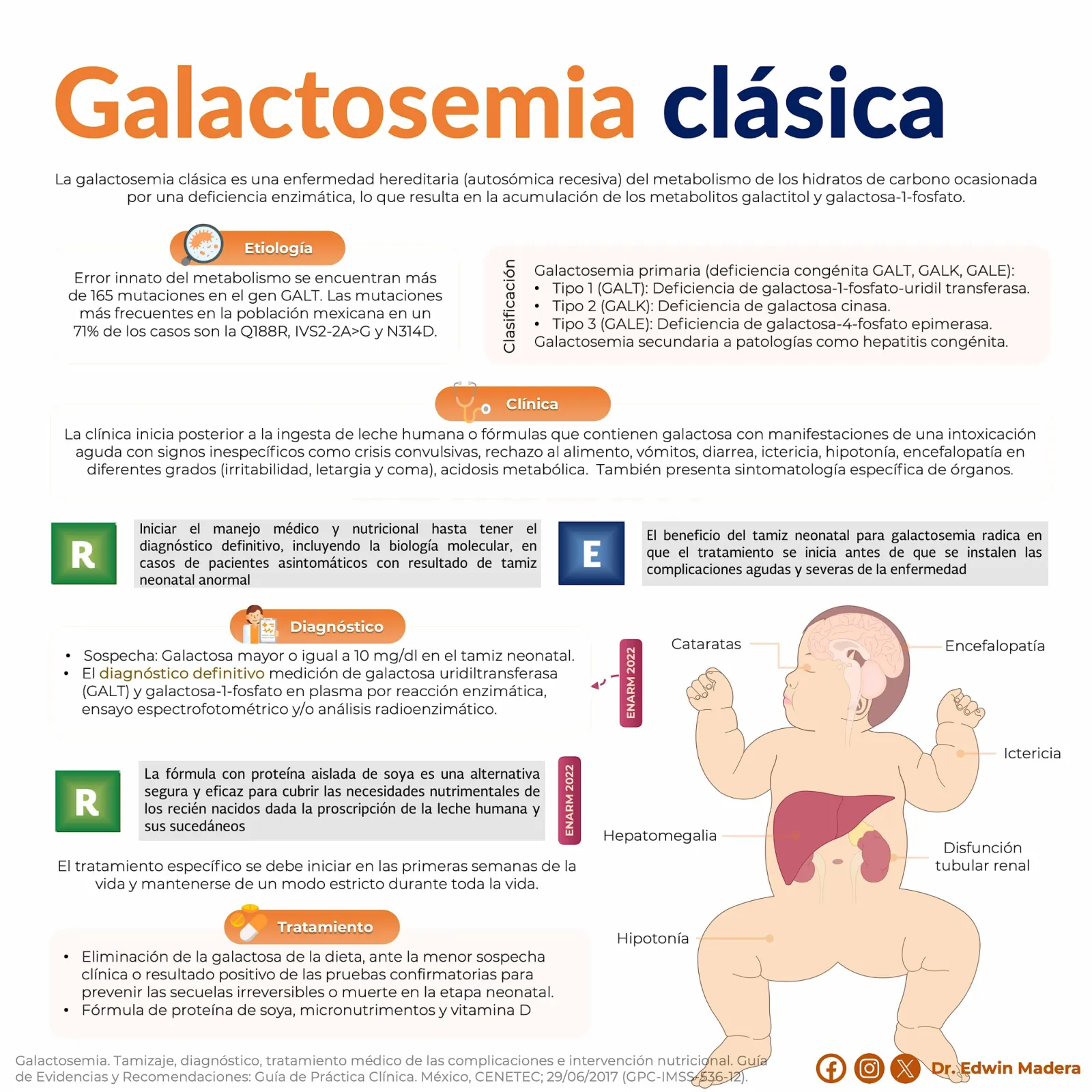 Galactosemia clásica