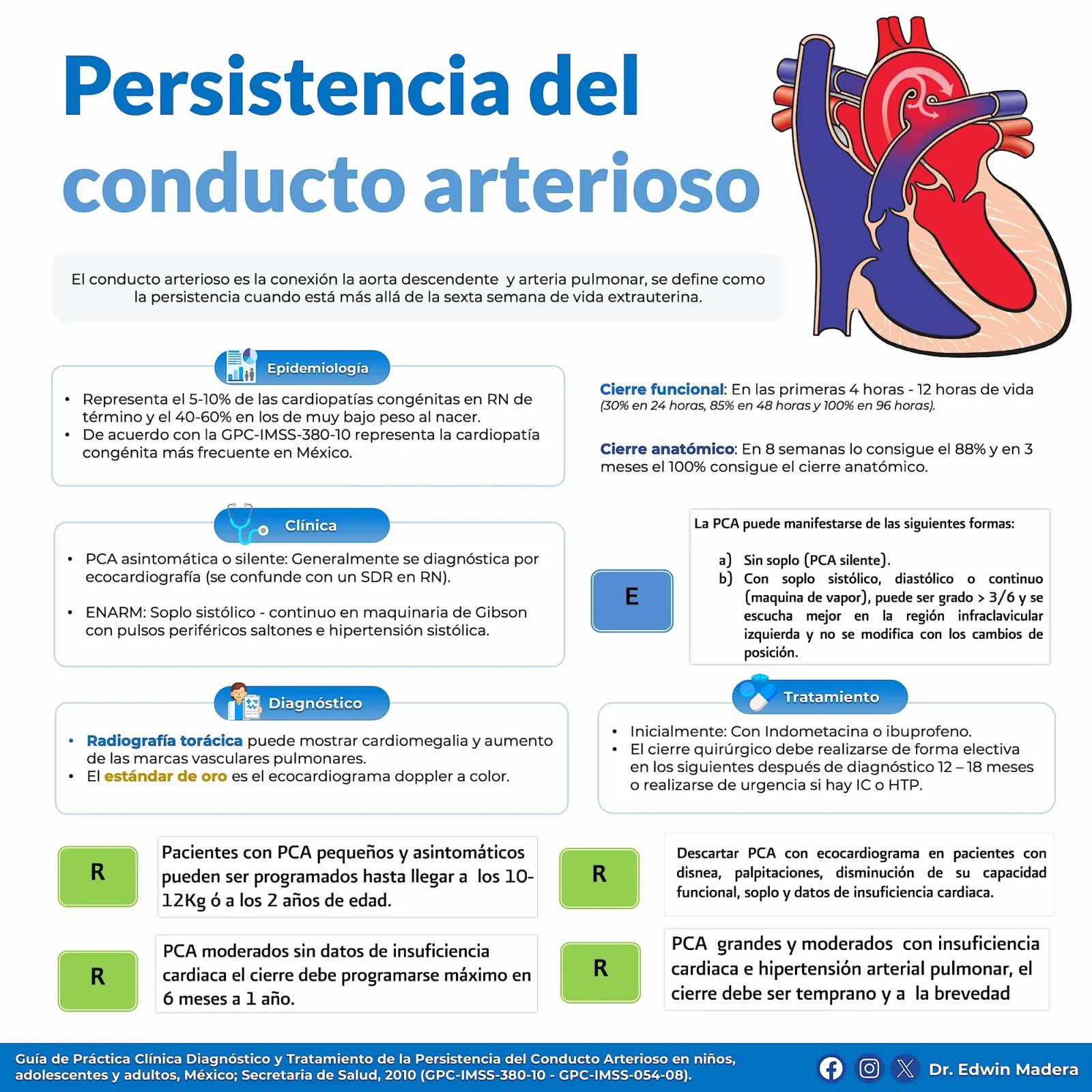 Persistencia del conducto arterioso