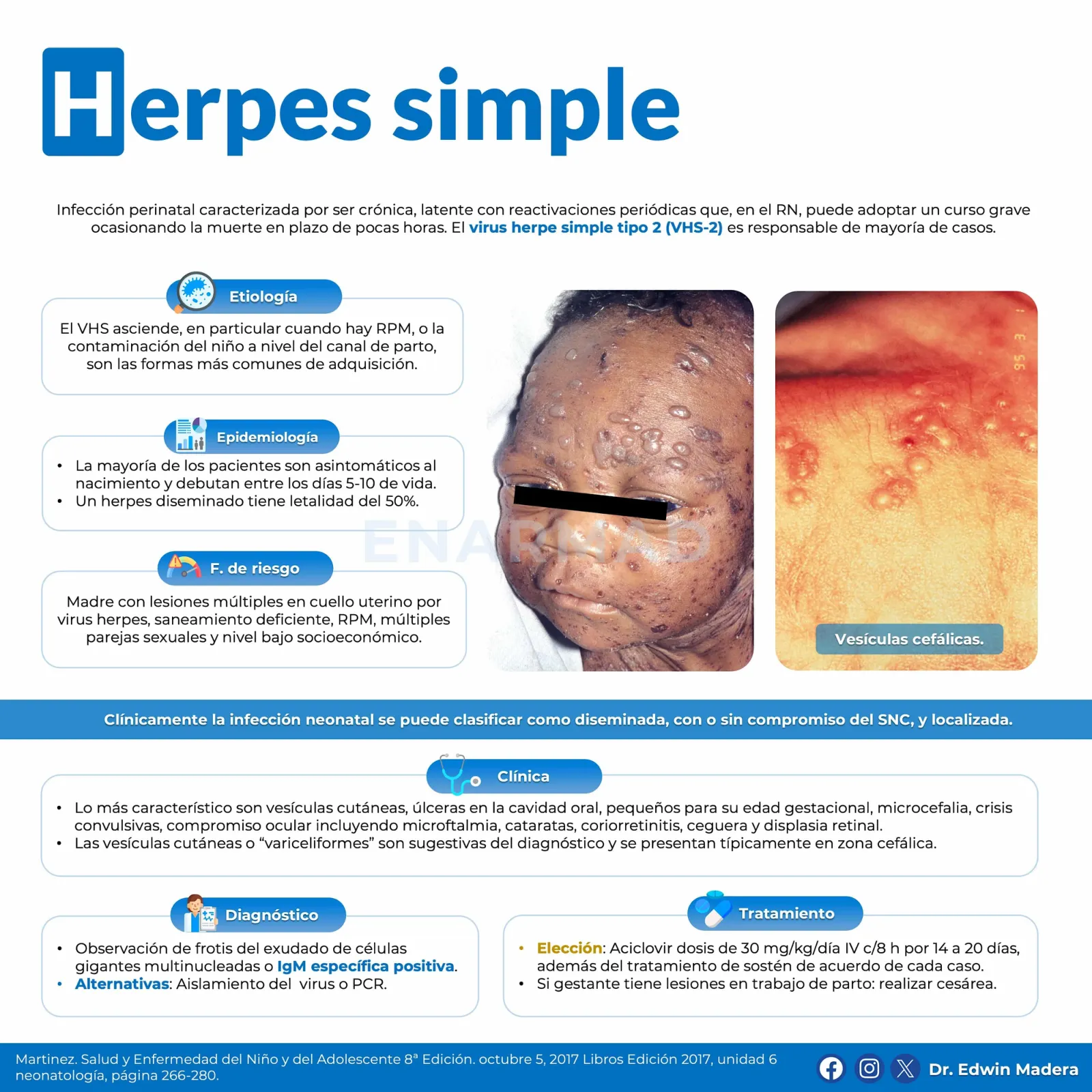 STORCH Herpes simple