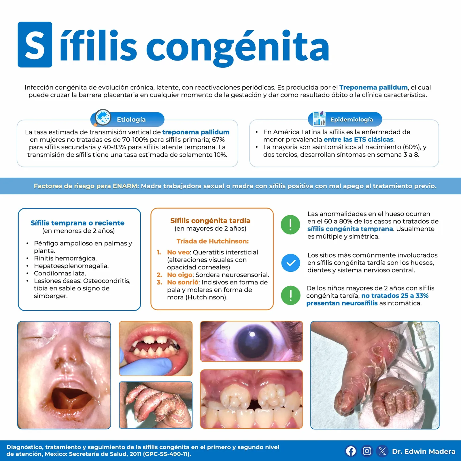 STORCH Sífilis congénita