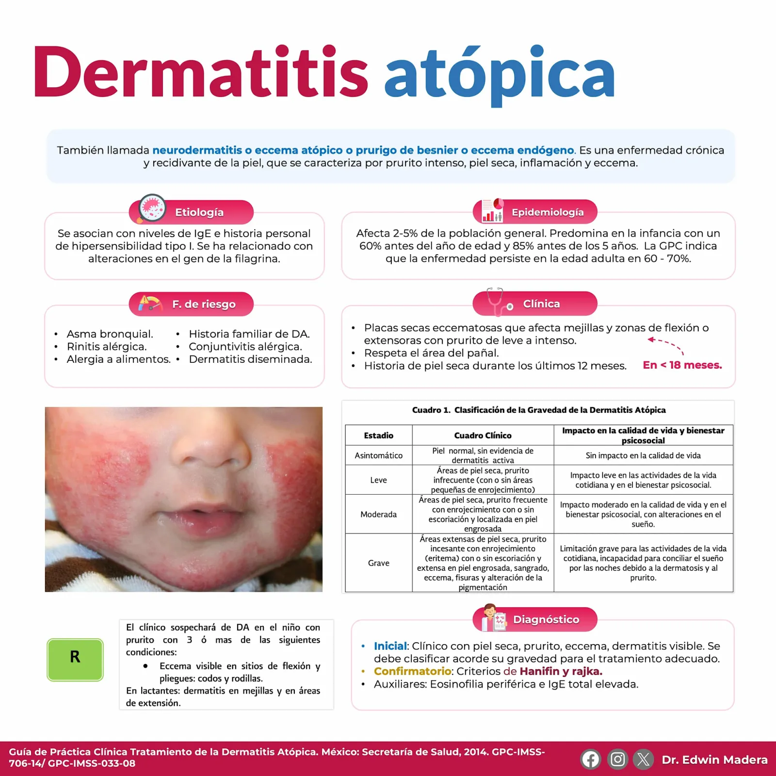 Dermatitis atópica