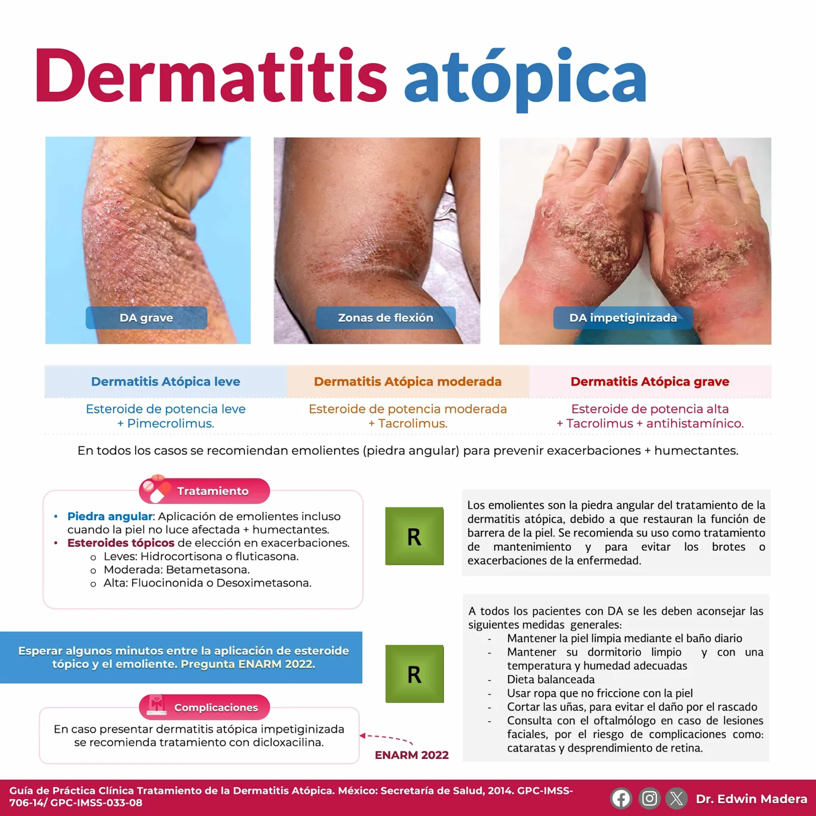 Dermatitis atópica