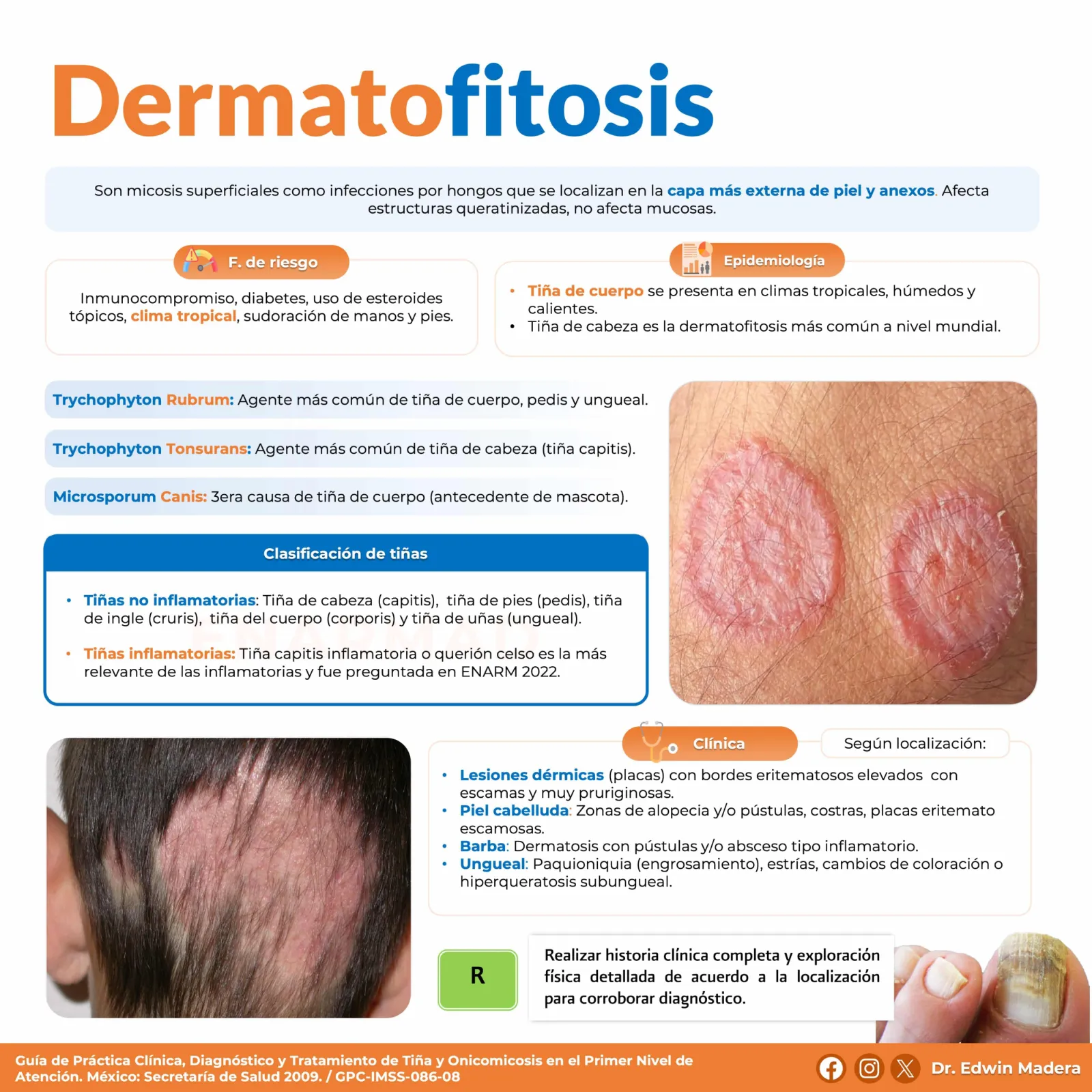 Dermatofitosis