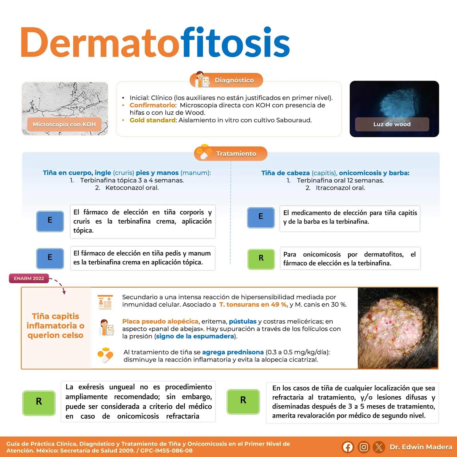 Dermatofitosis