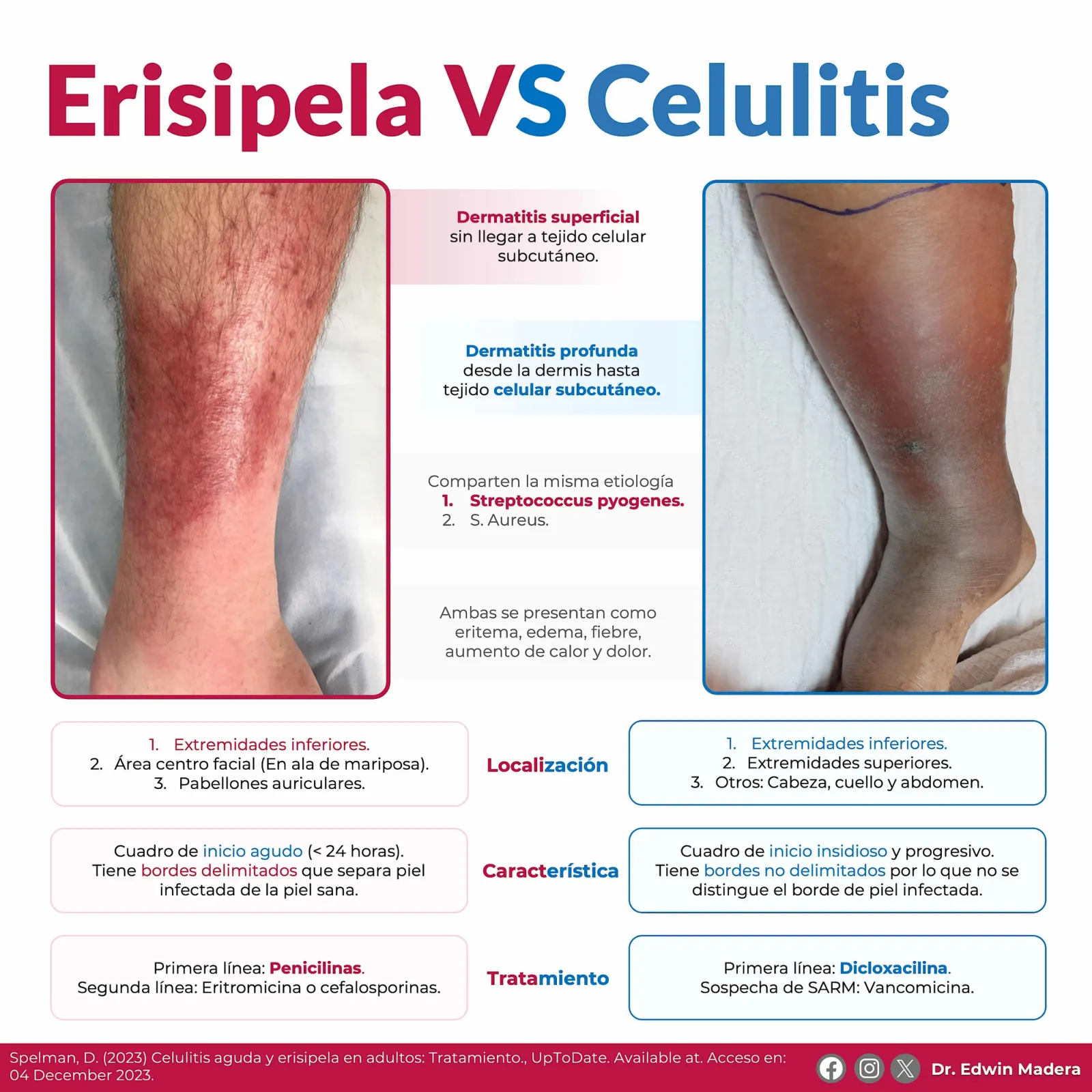 Erispela