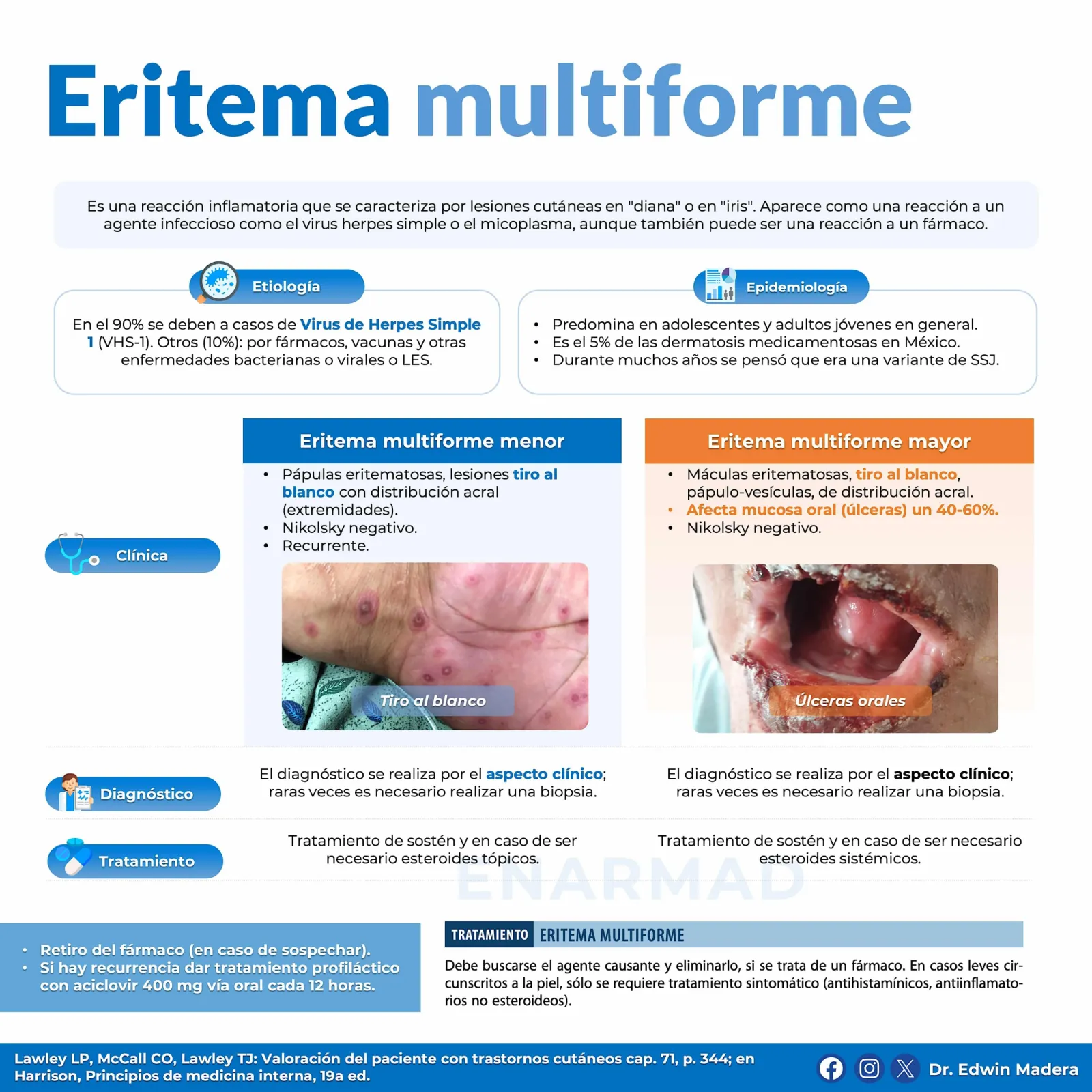 Eritema multiforme