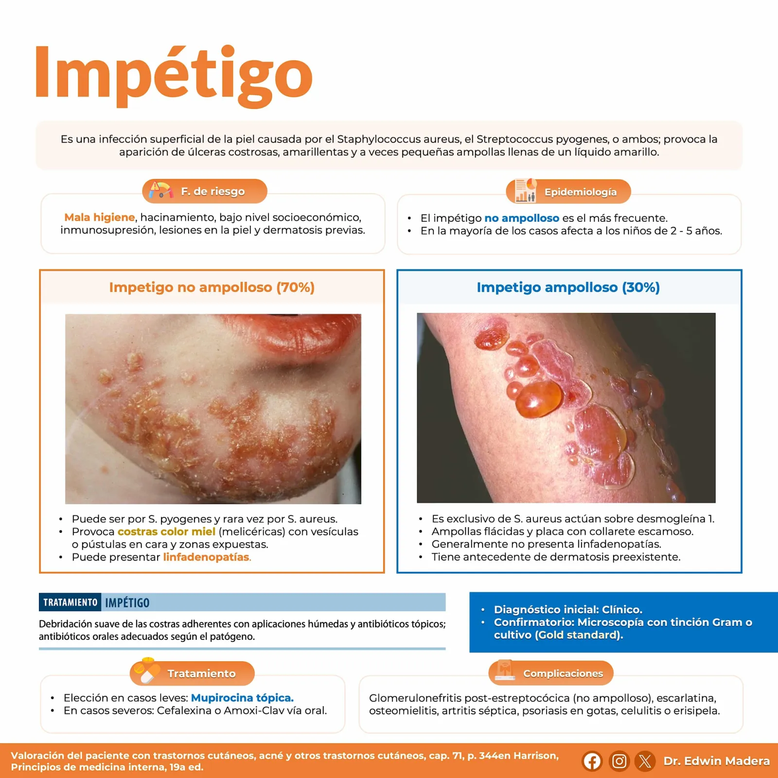 Impétigo
