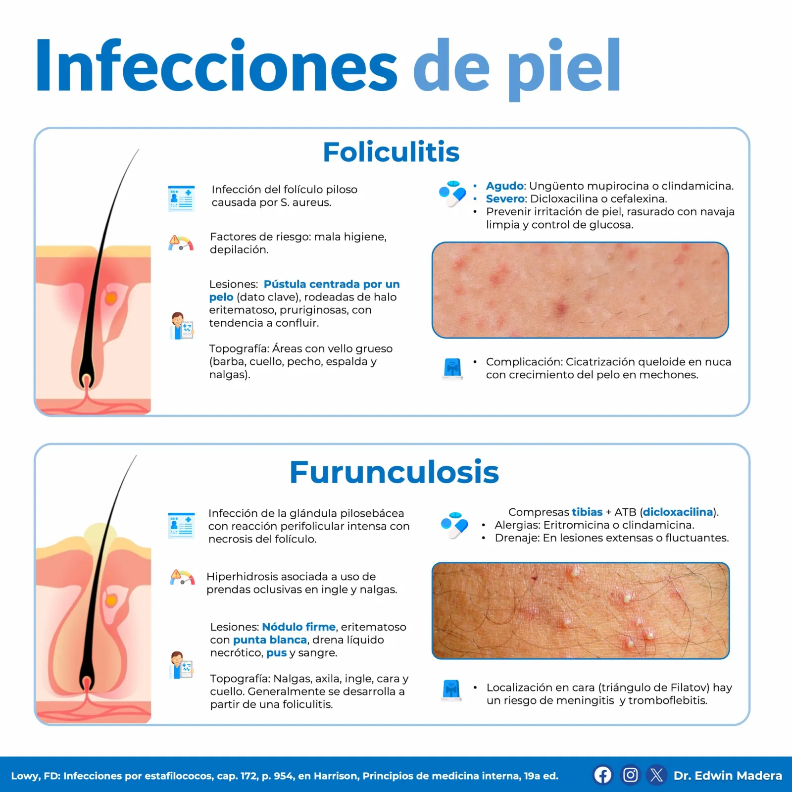 Infecciones de piel
