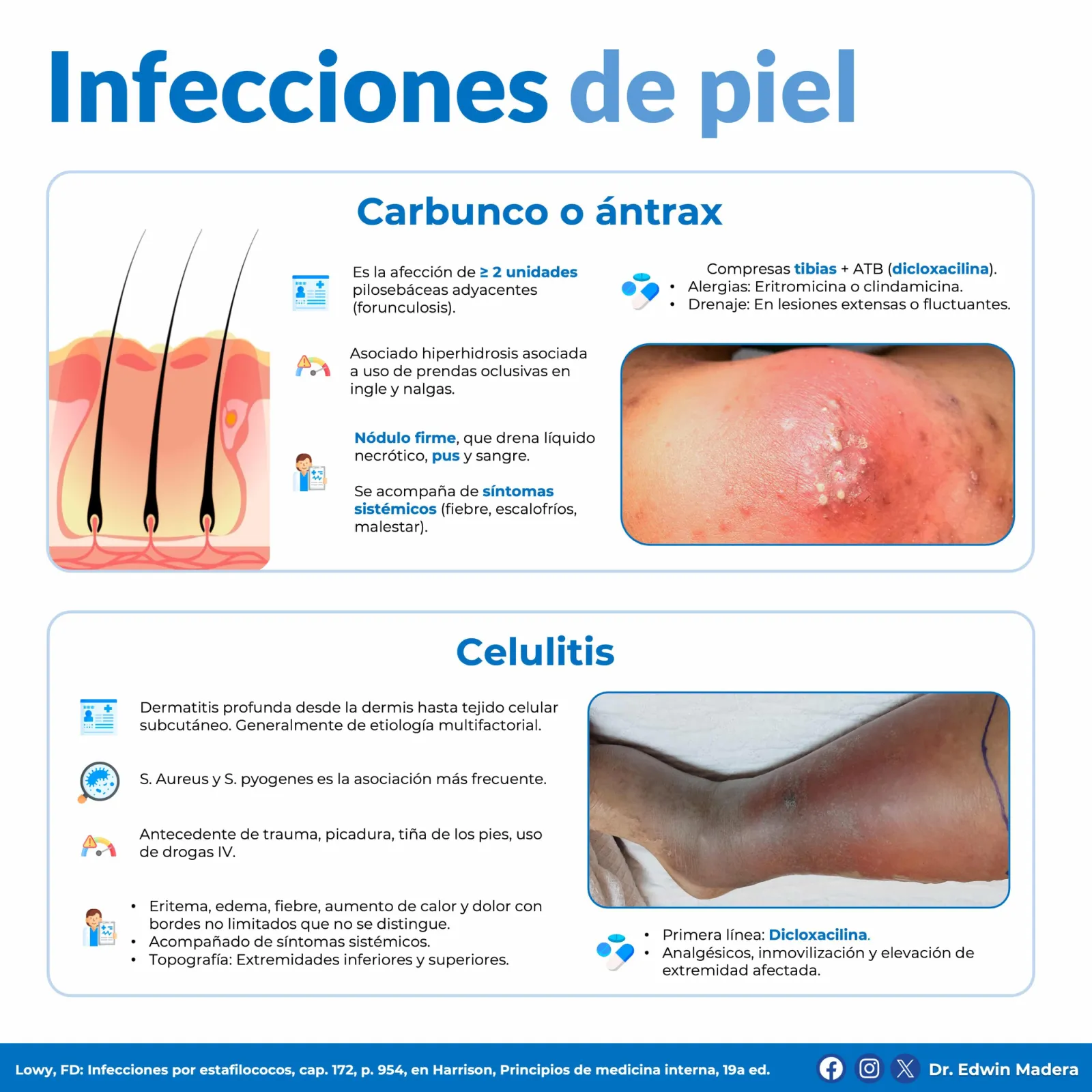 Infecciones de piel