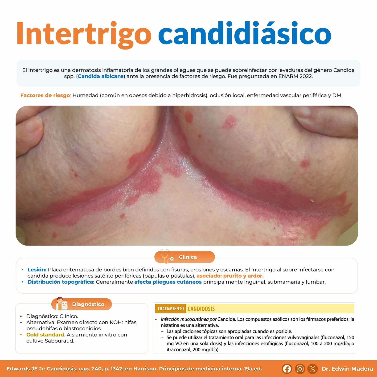 Intertrigo candidiásico