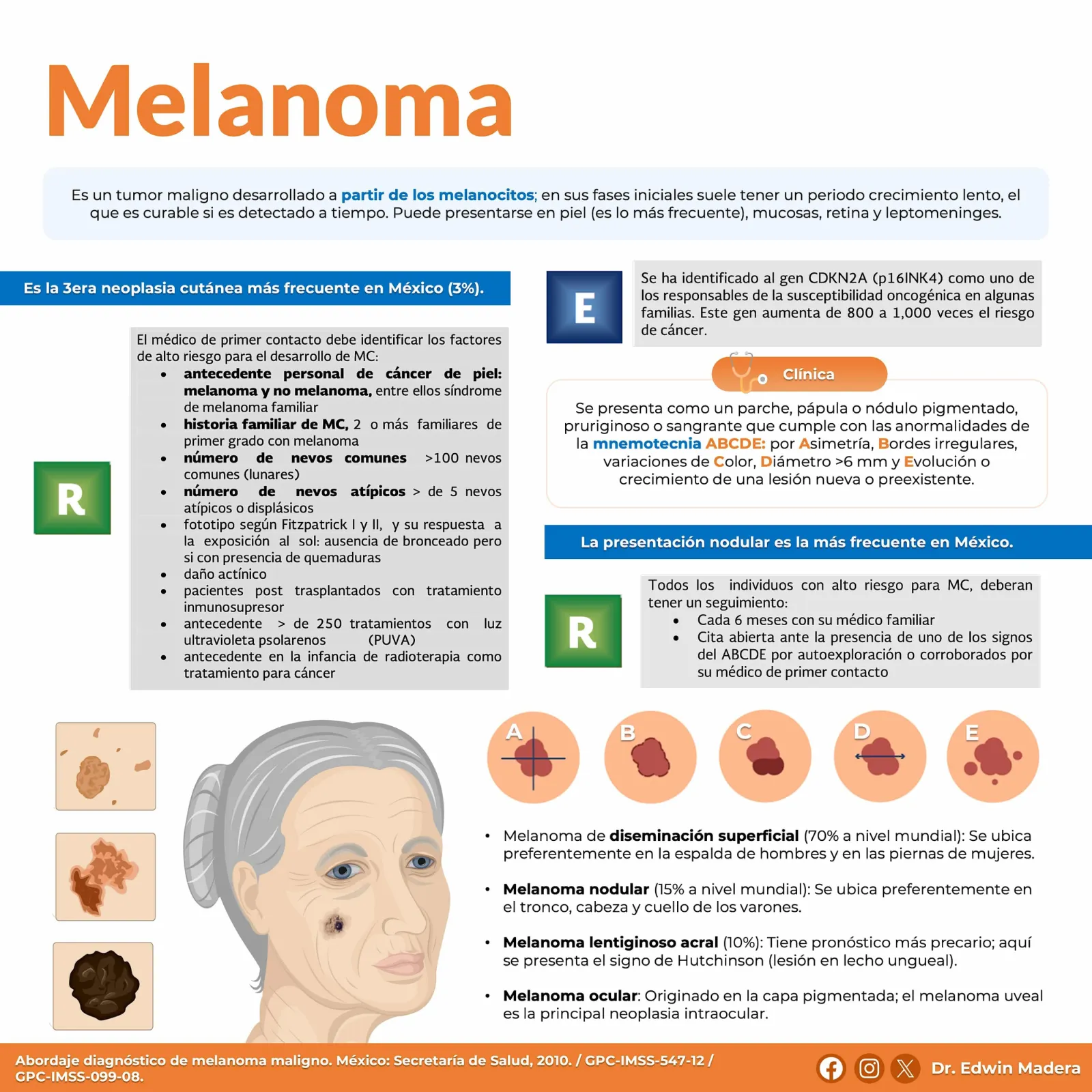 Melanoma
