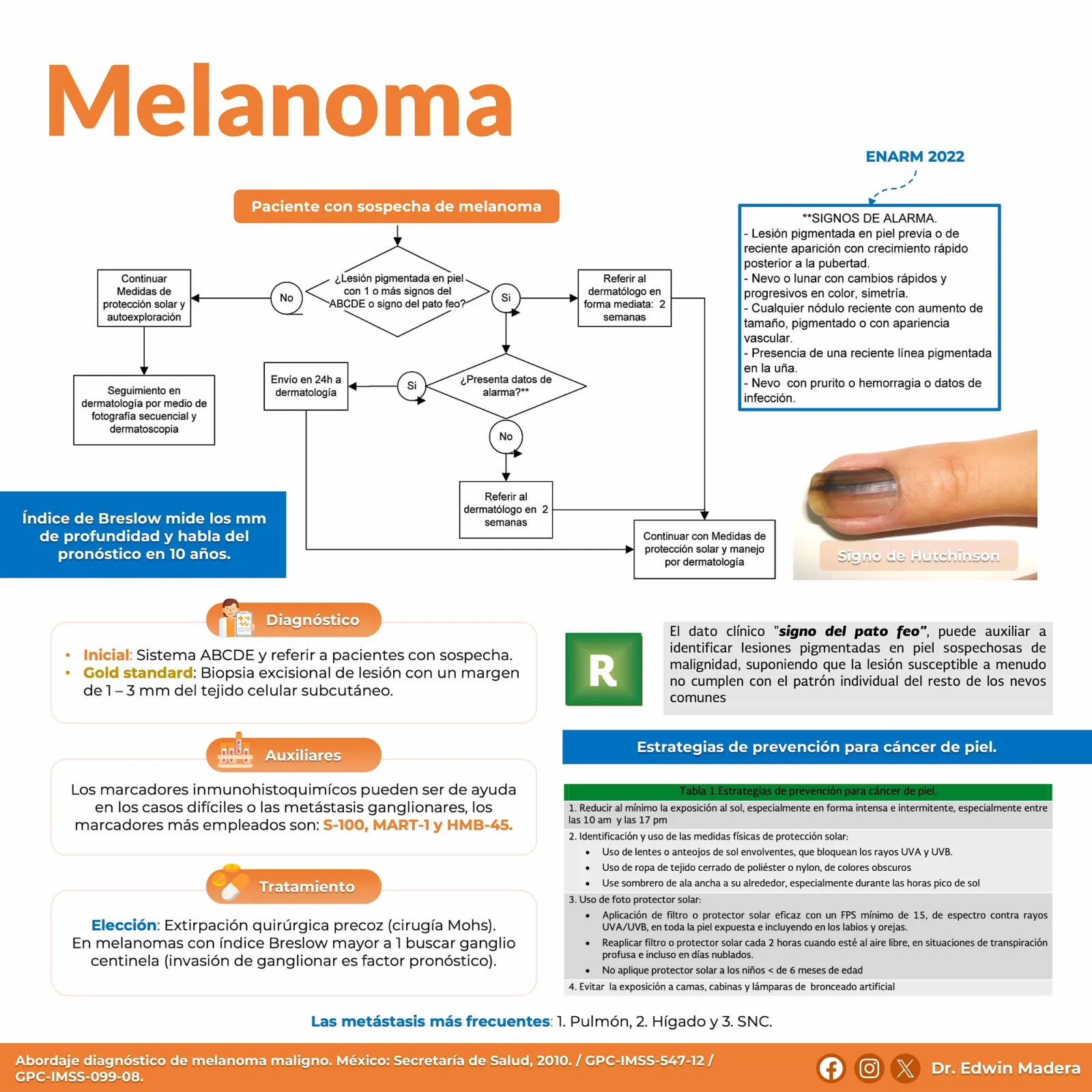 Melanoma
