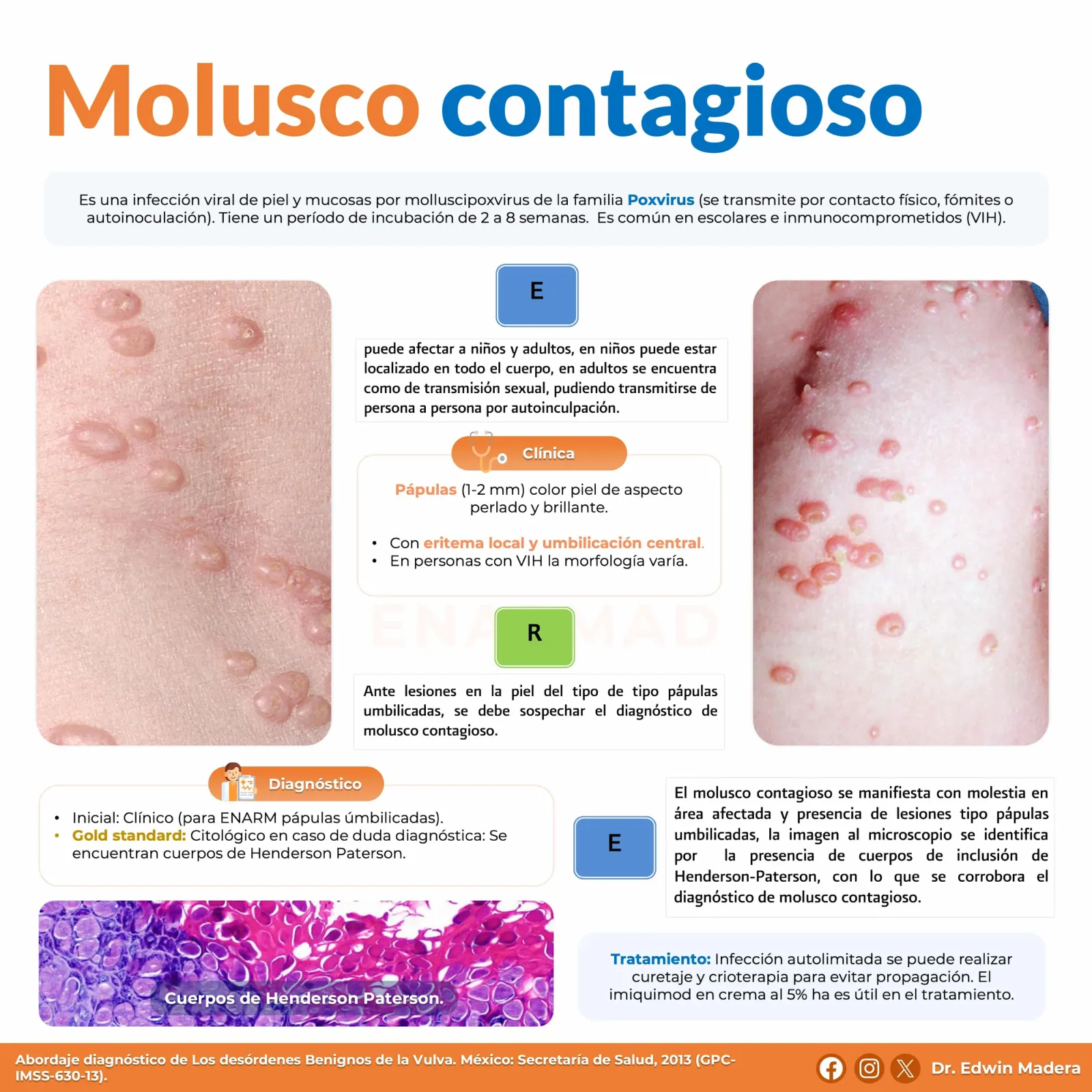 Molusco contagioso