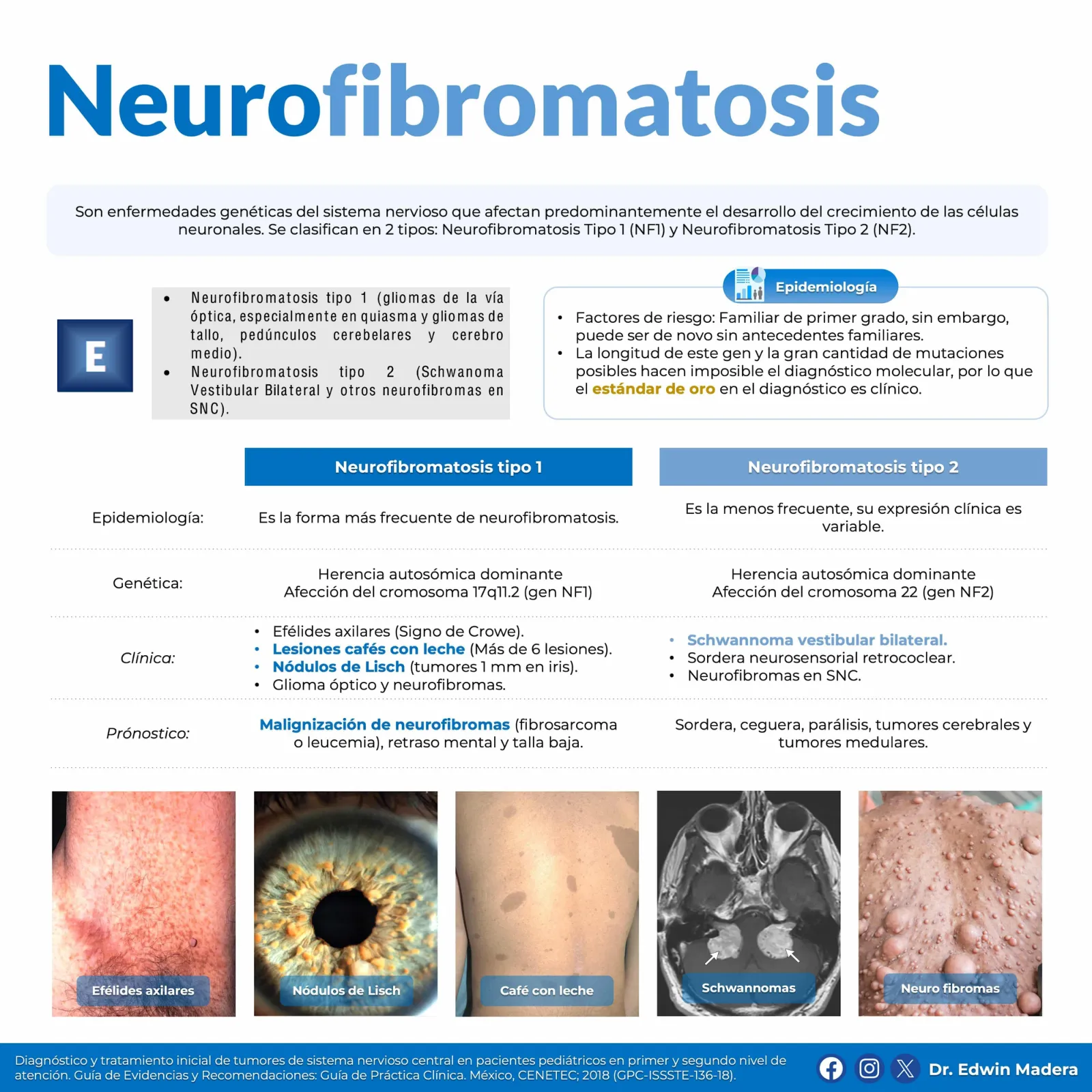 Neurofibromatosis