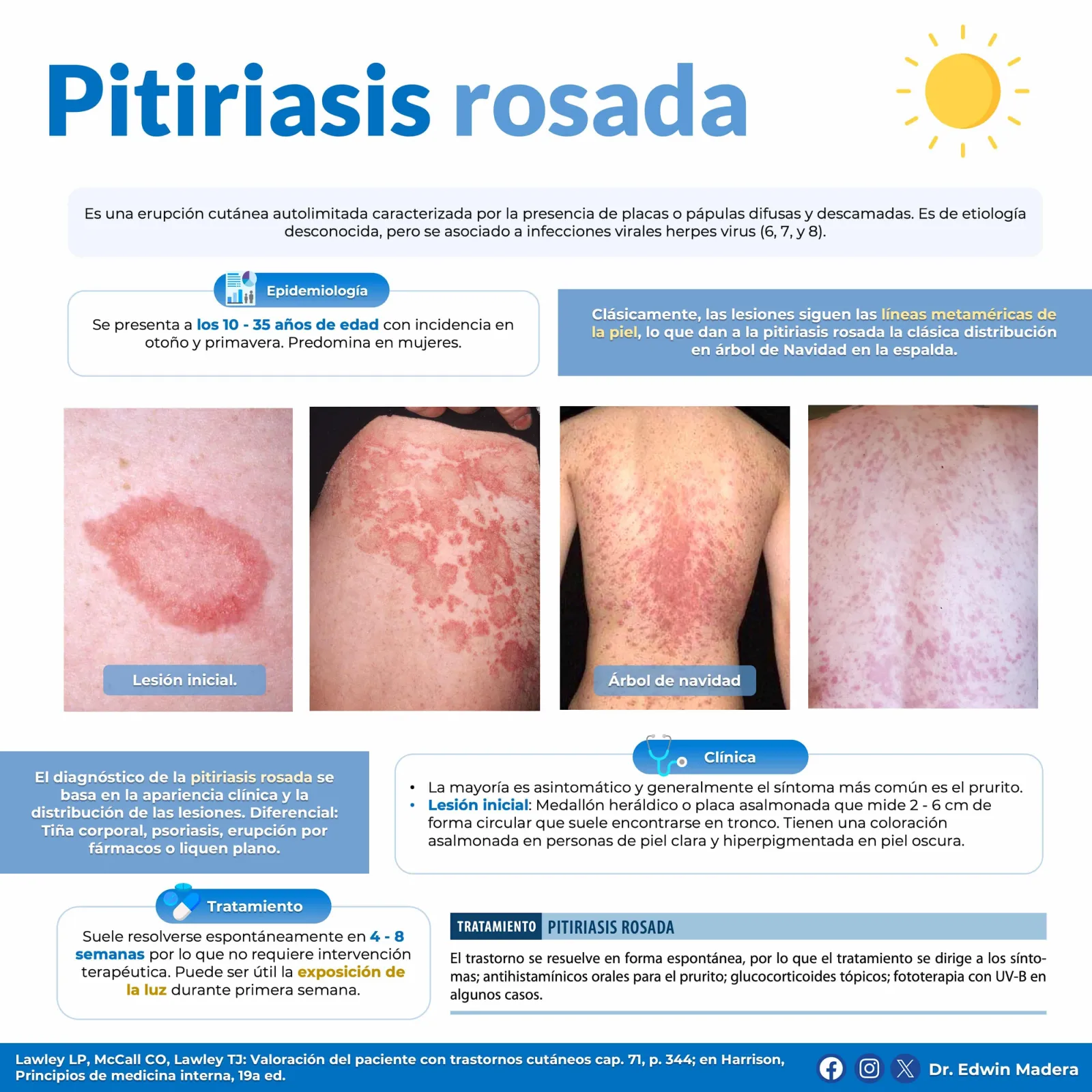 Pitiriasis rosada de Gibert
