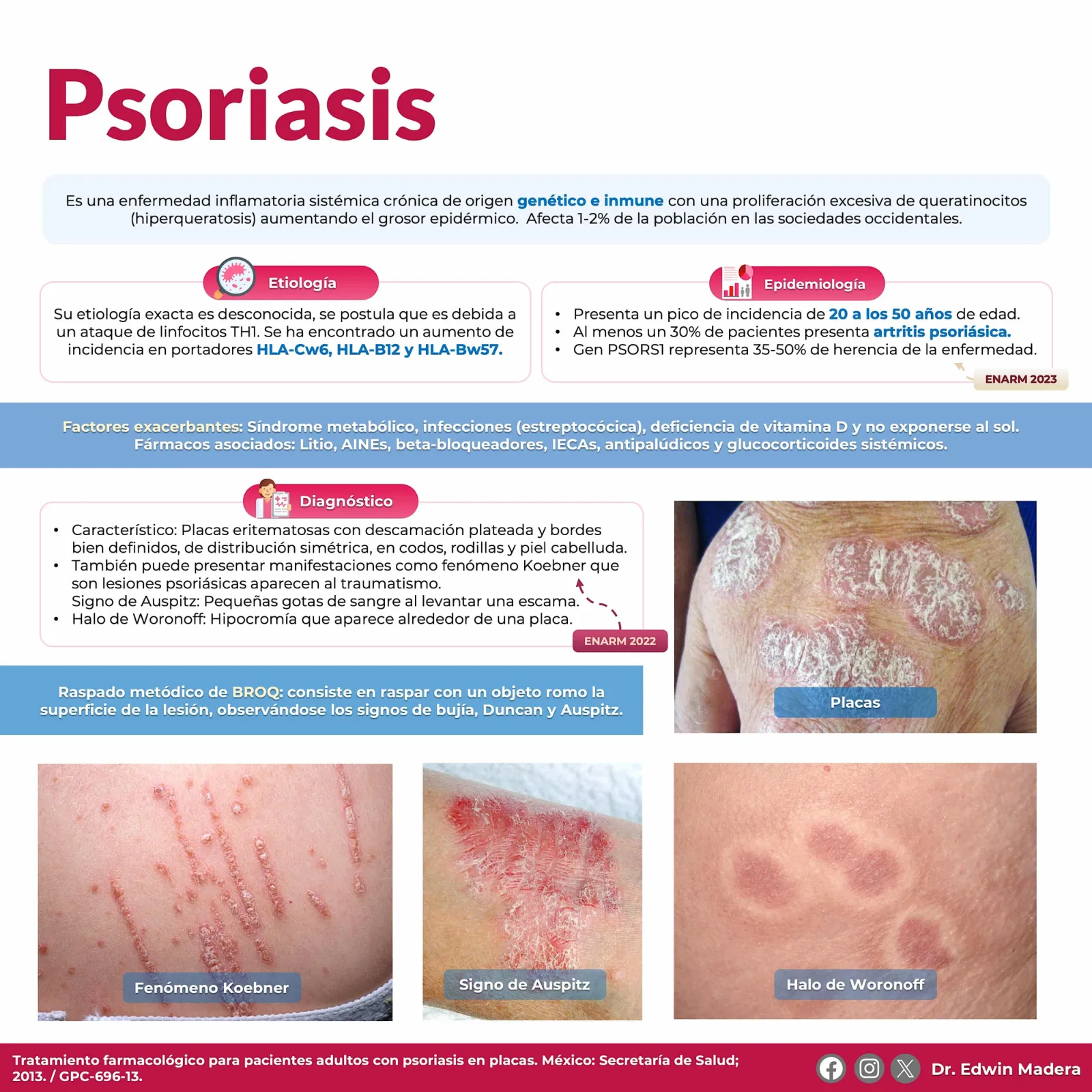 Psoriasis
