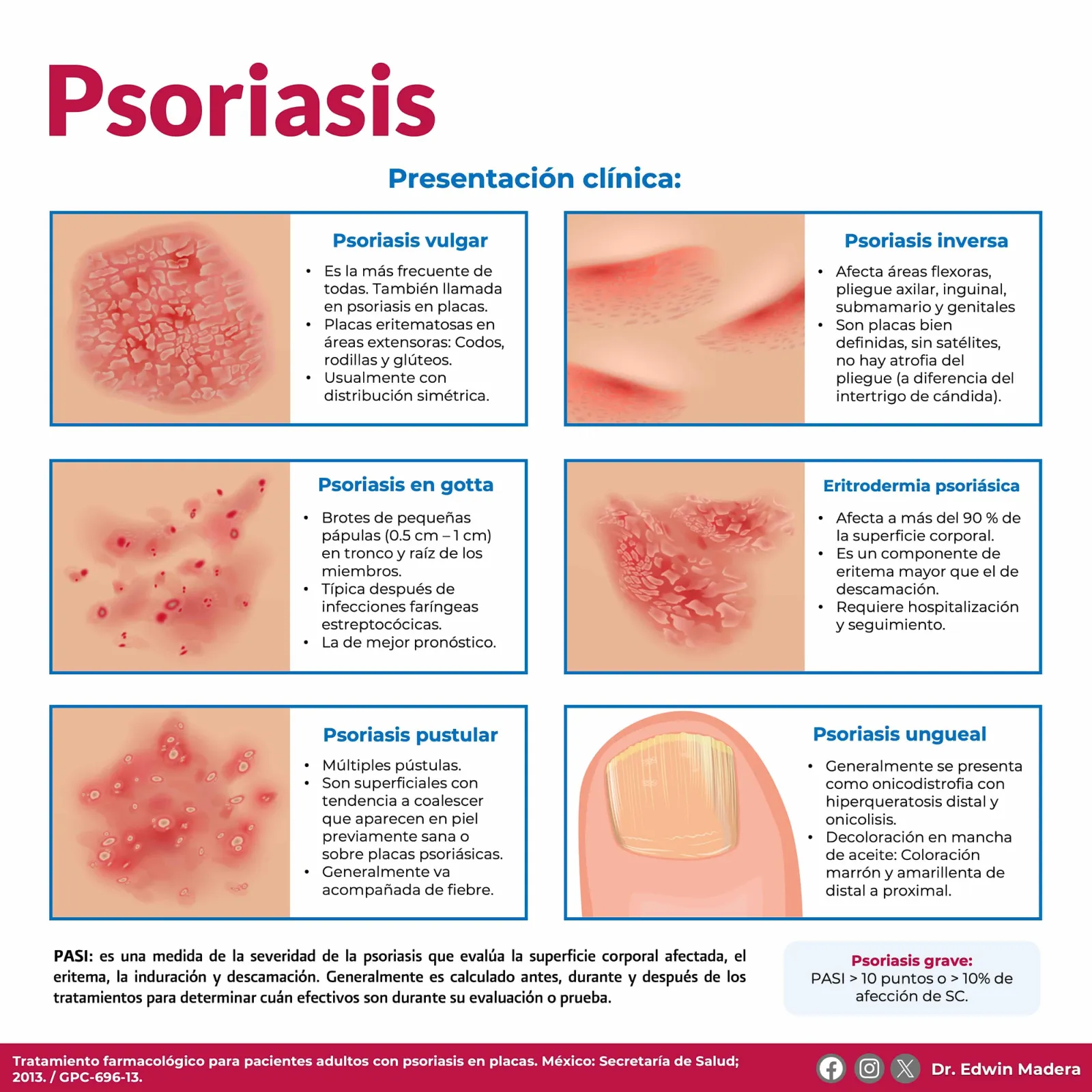 Psoriasis
