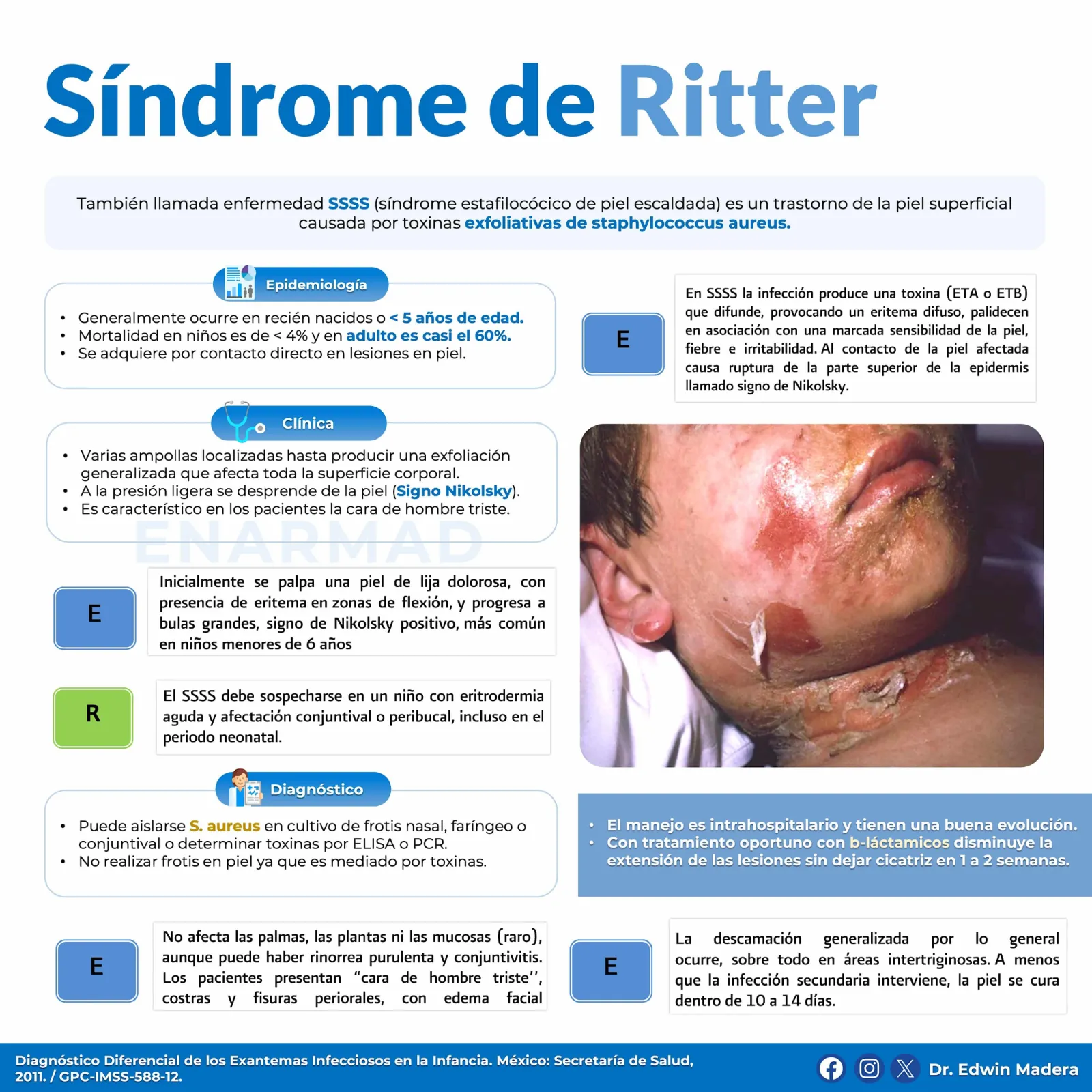 Síndrome de Ritter