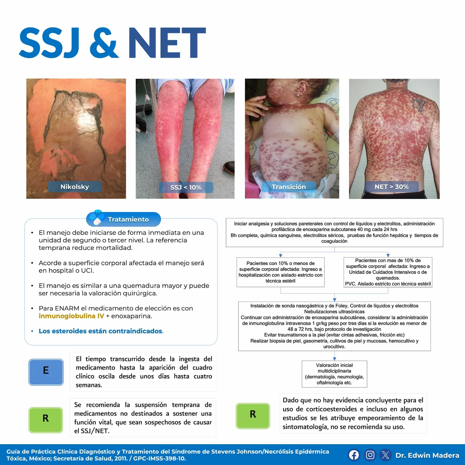 SSJ y NET