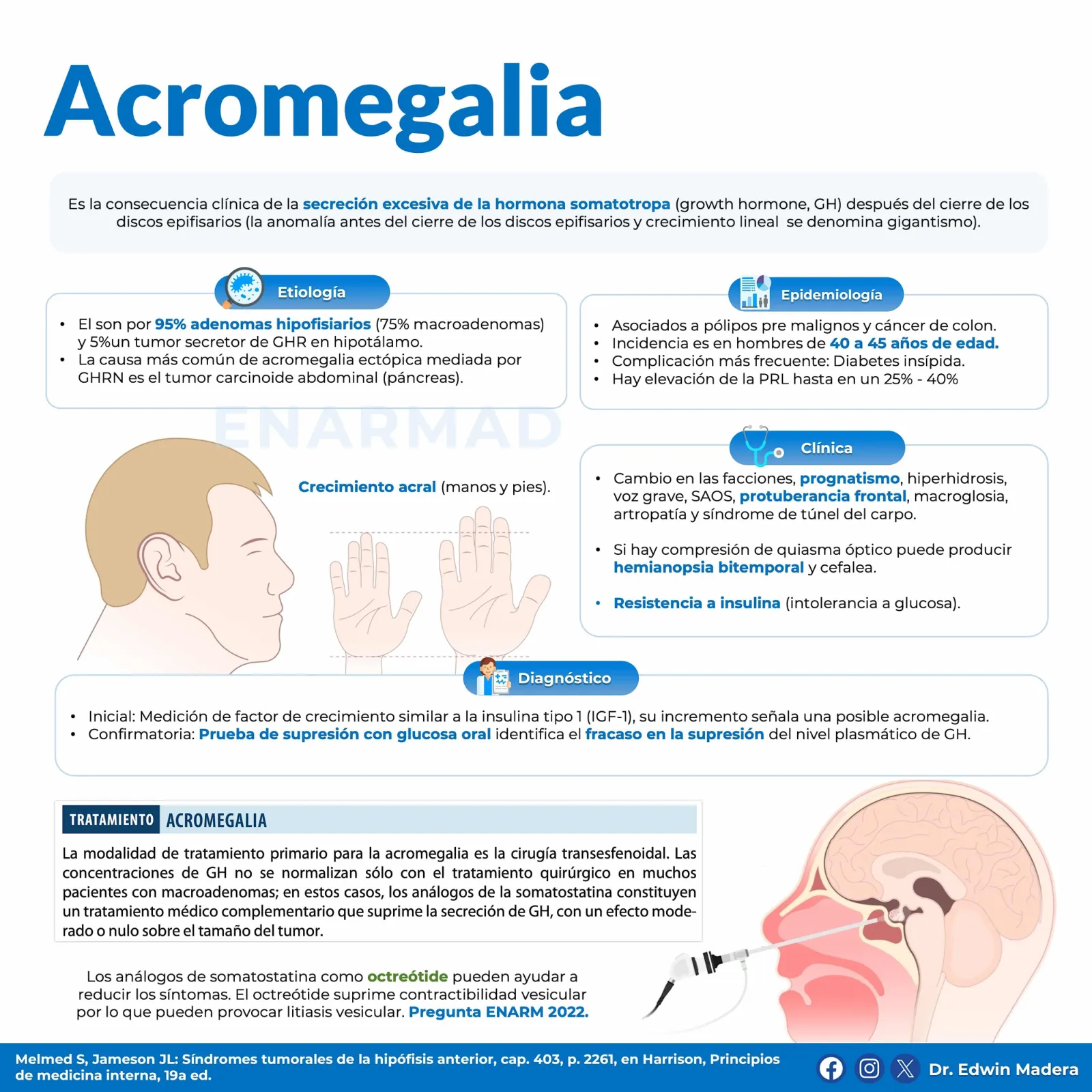 Acromegalia