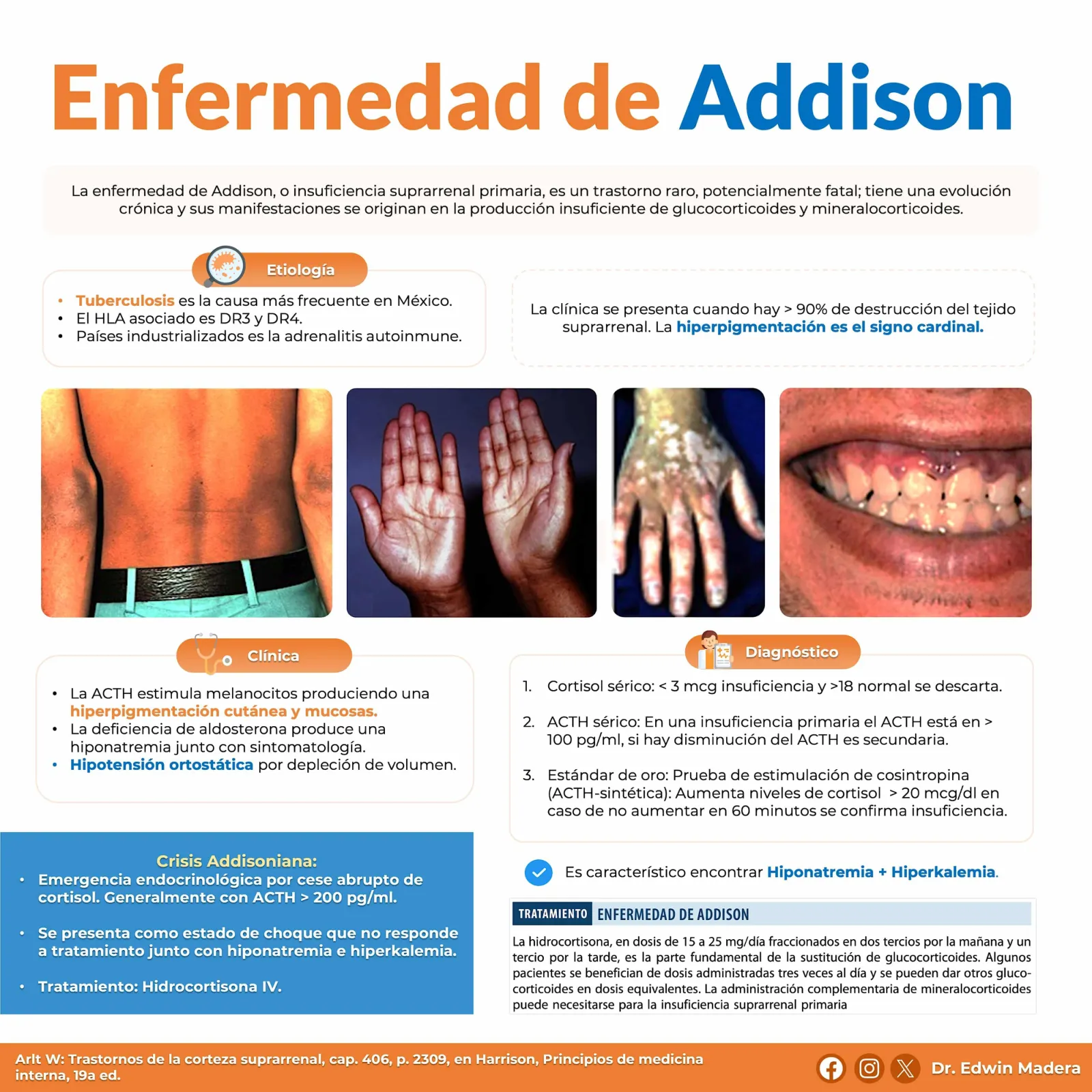 Enfermedad de Addison