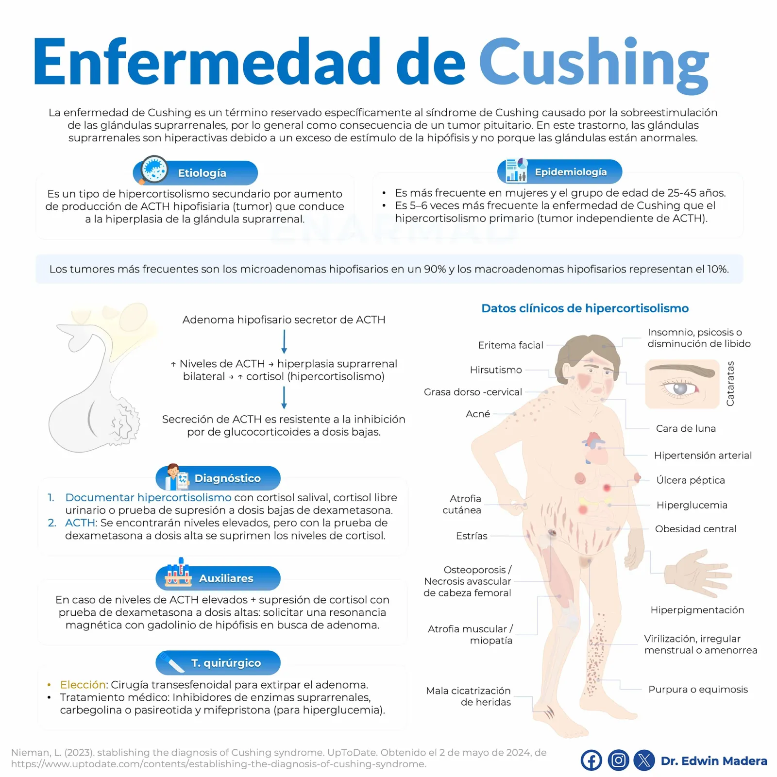 Enfermedad de Cushing