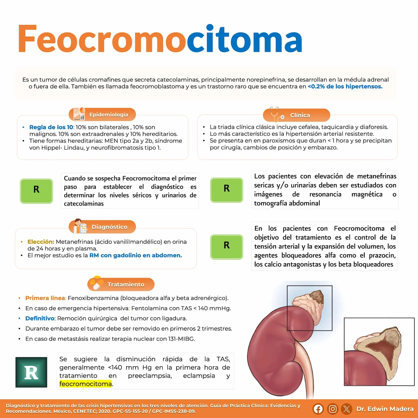 Feocromocitoma