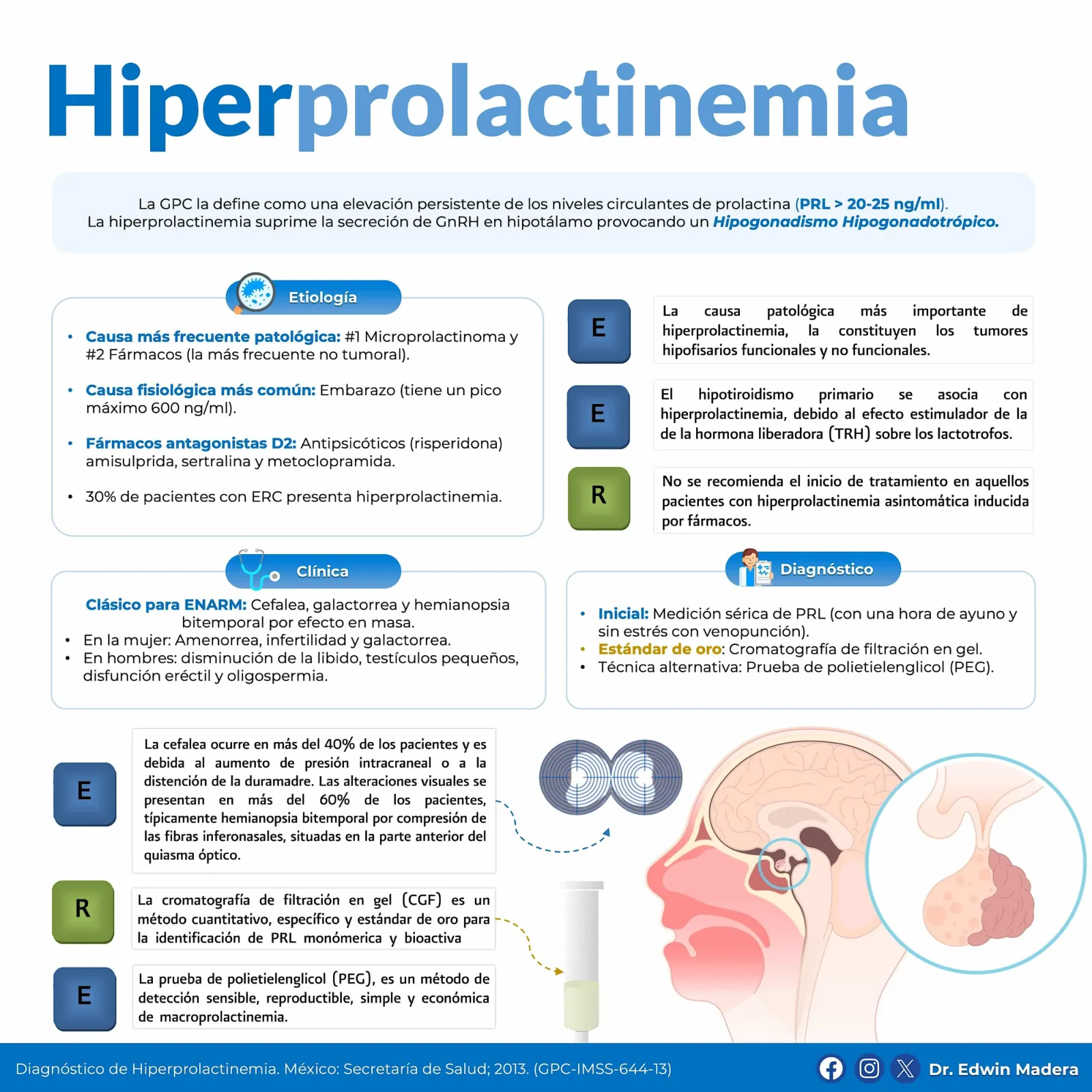 Hiperprolactinemia