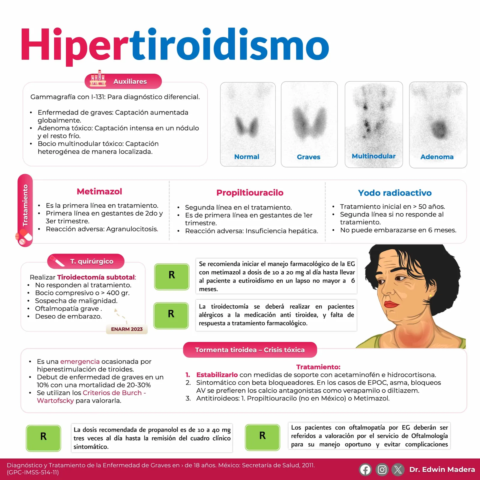 Hipertiroidismo
