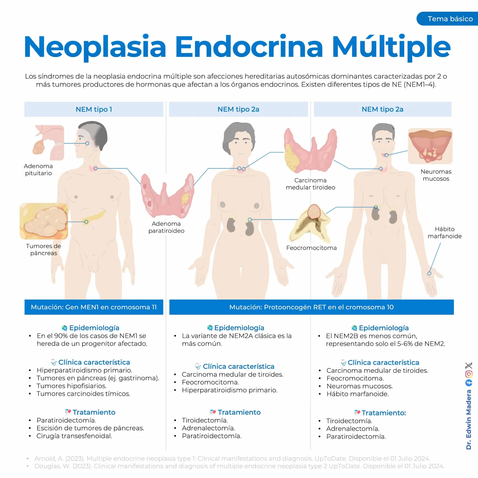 Neoplasia endocrina múltple