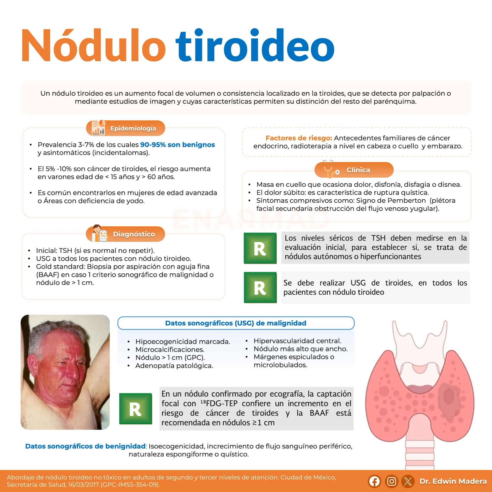 Nódulo tiroideo