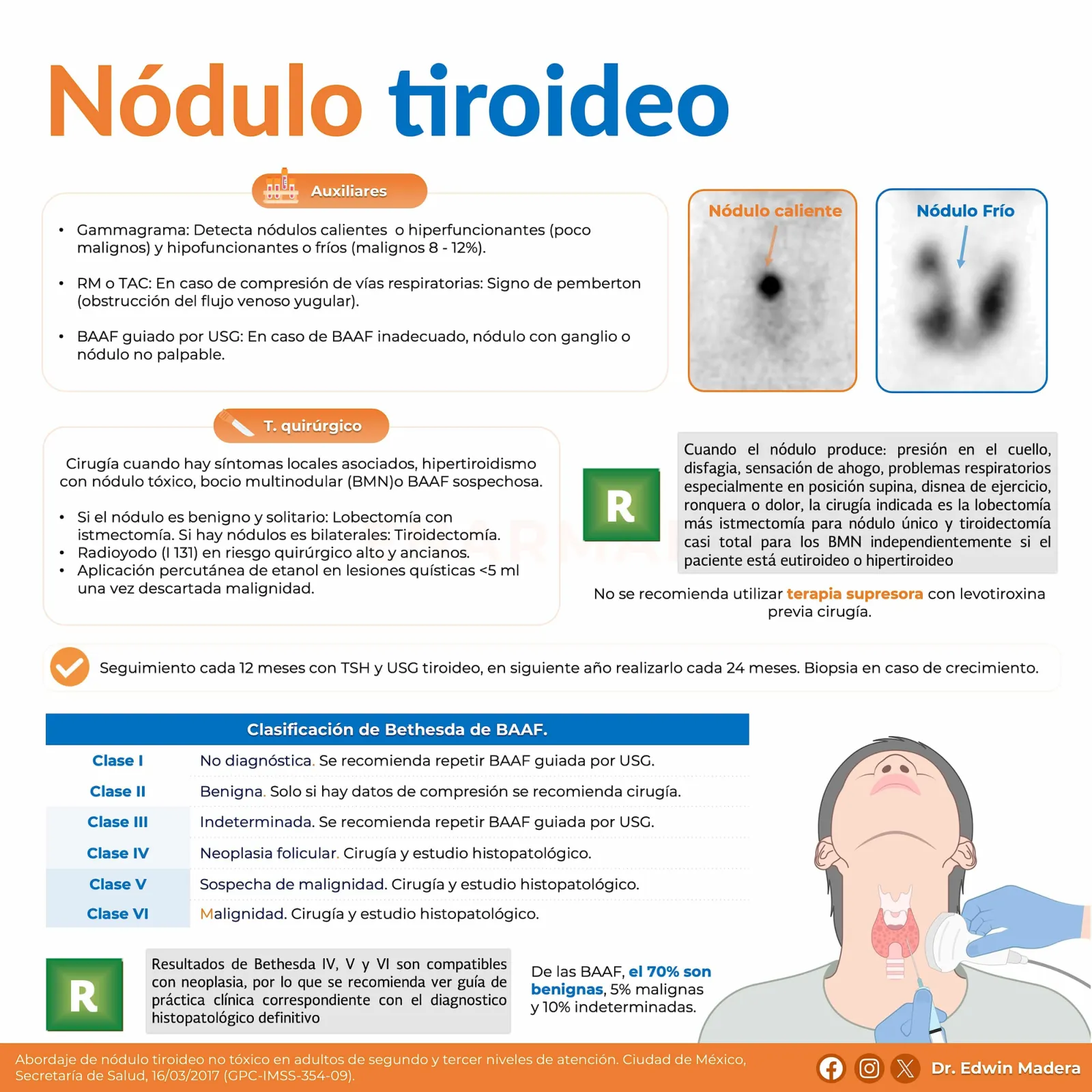 Nódulo tiroideo