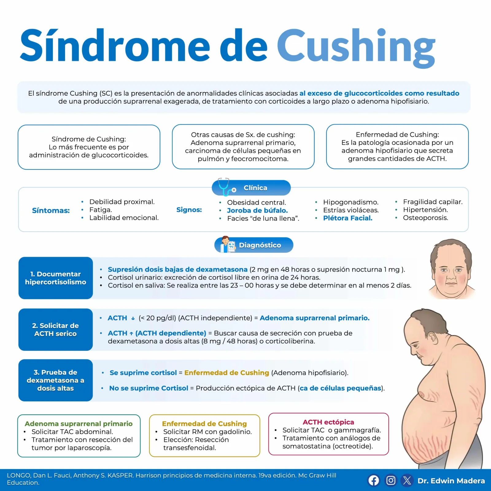 Síndrome de Cushing
