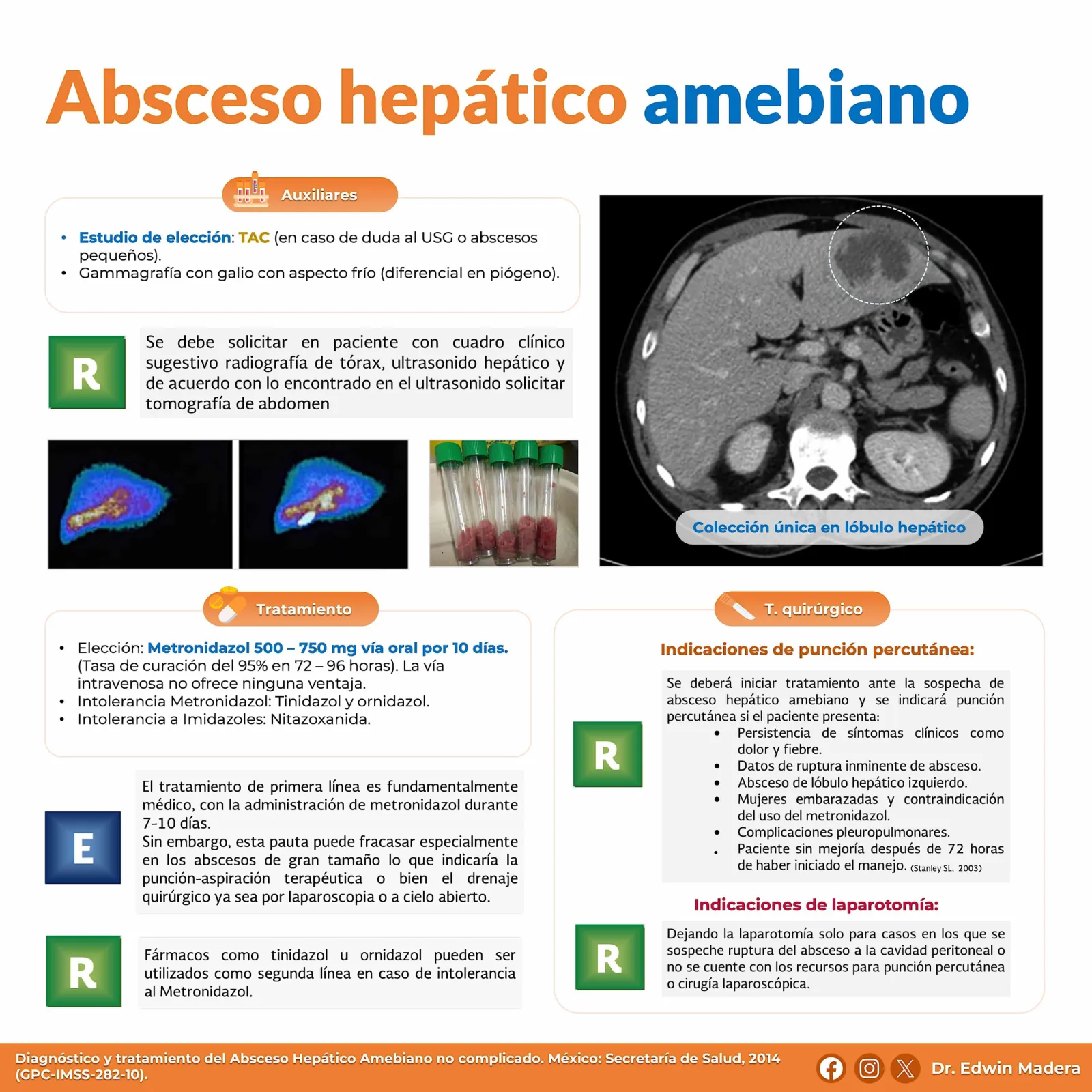 Absceso hepático amebiano