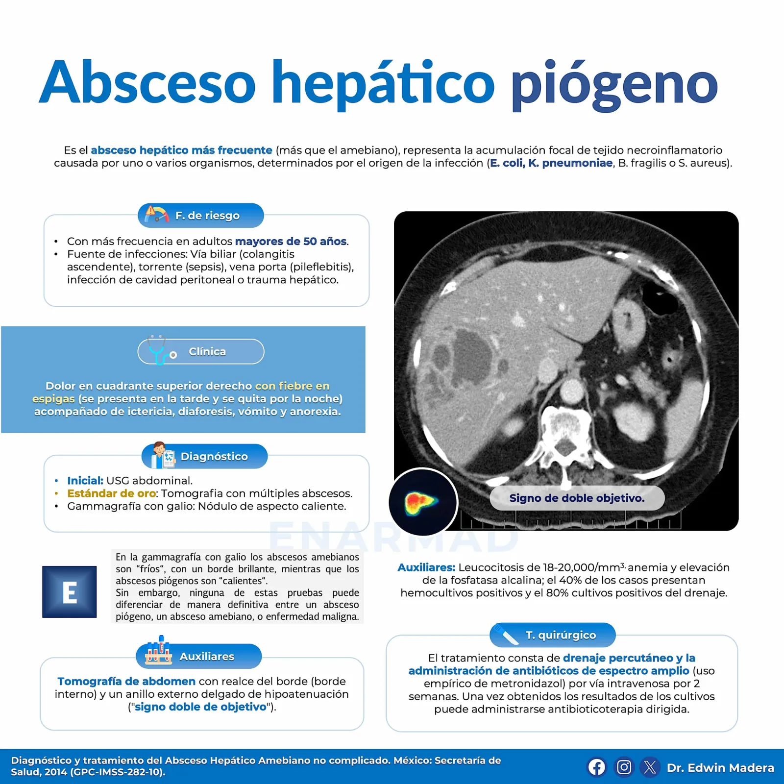 Absceso hepático piógeno