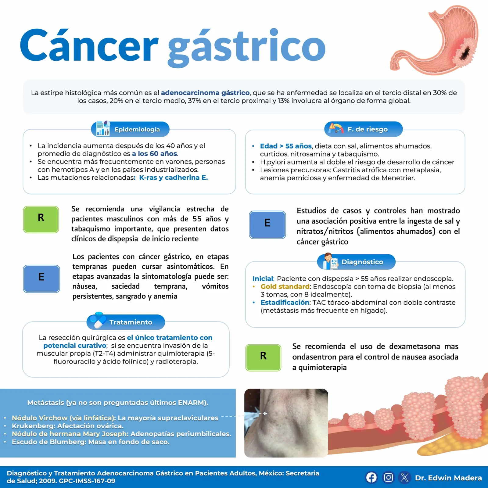 Cáncer gástrico