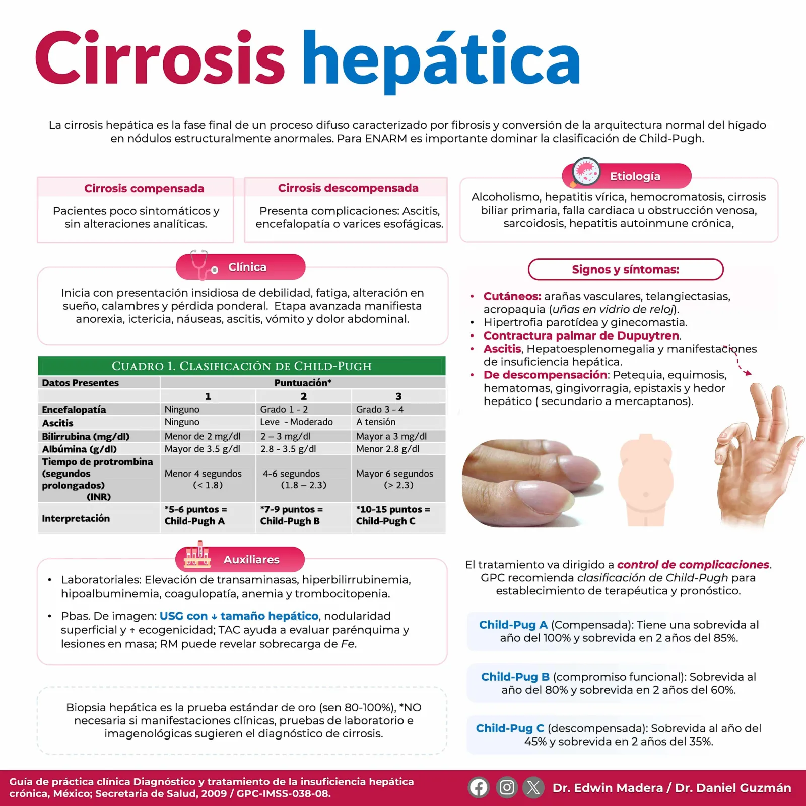 Cirrosis hepática