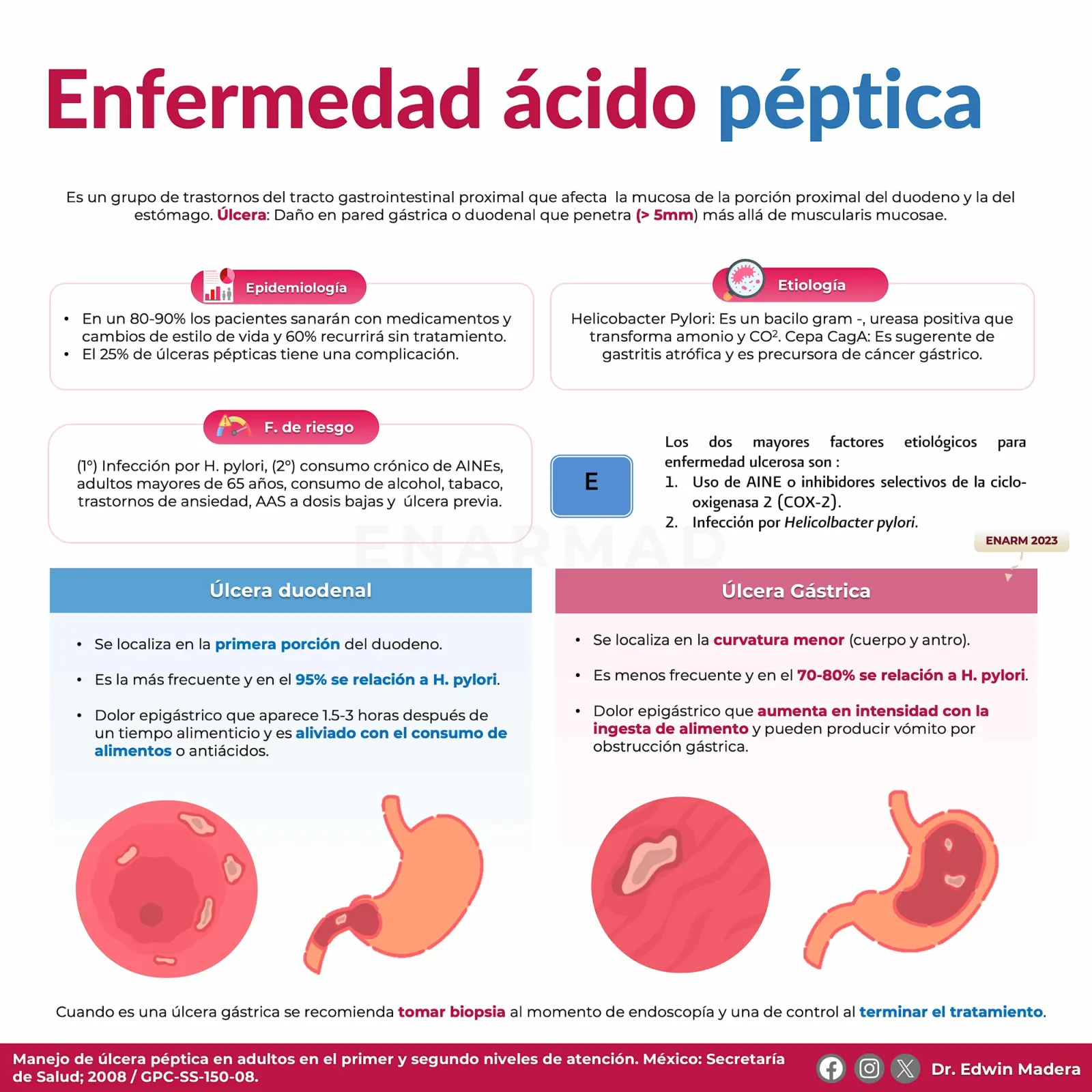 Enfermedad ácido péptica