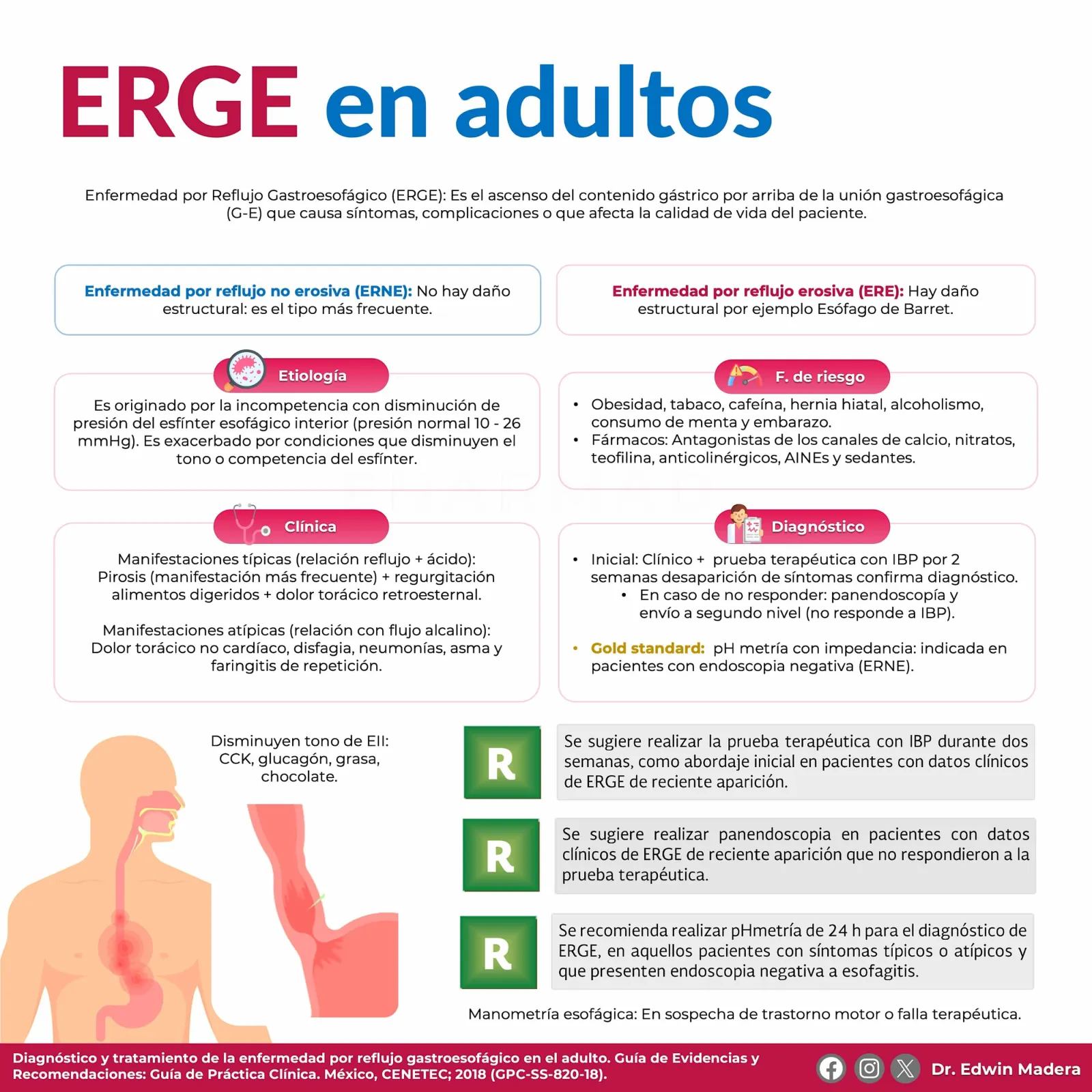 ERGE
