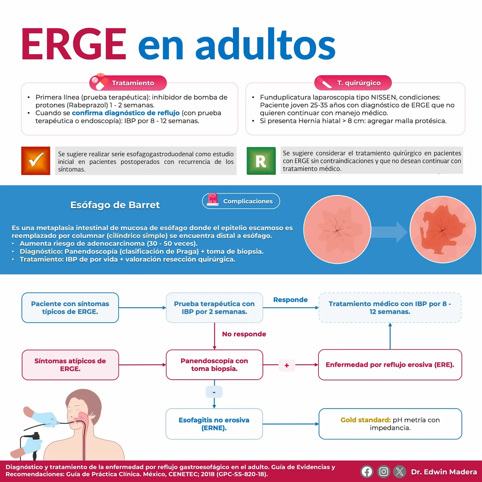 ERGE