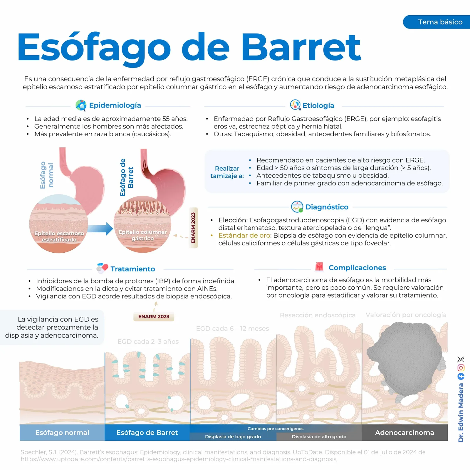 Esófago de Barret