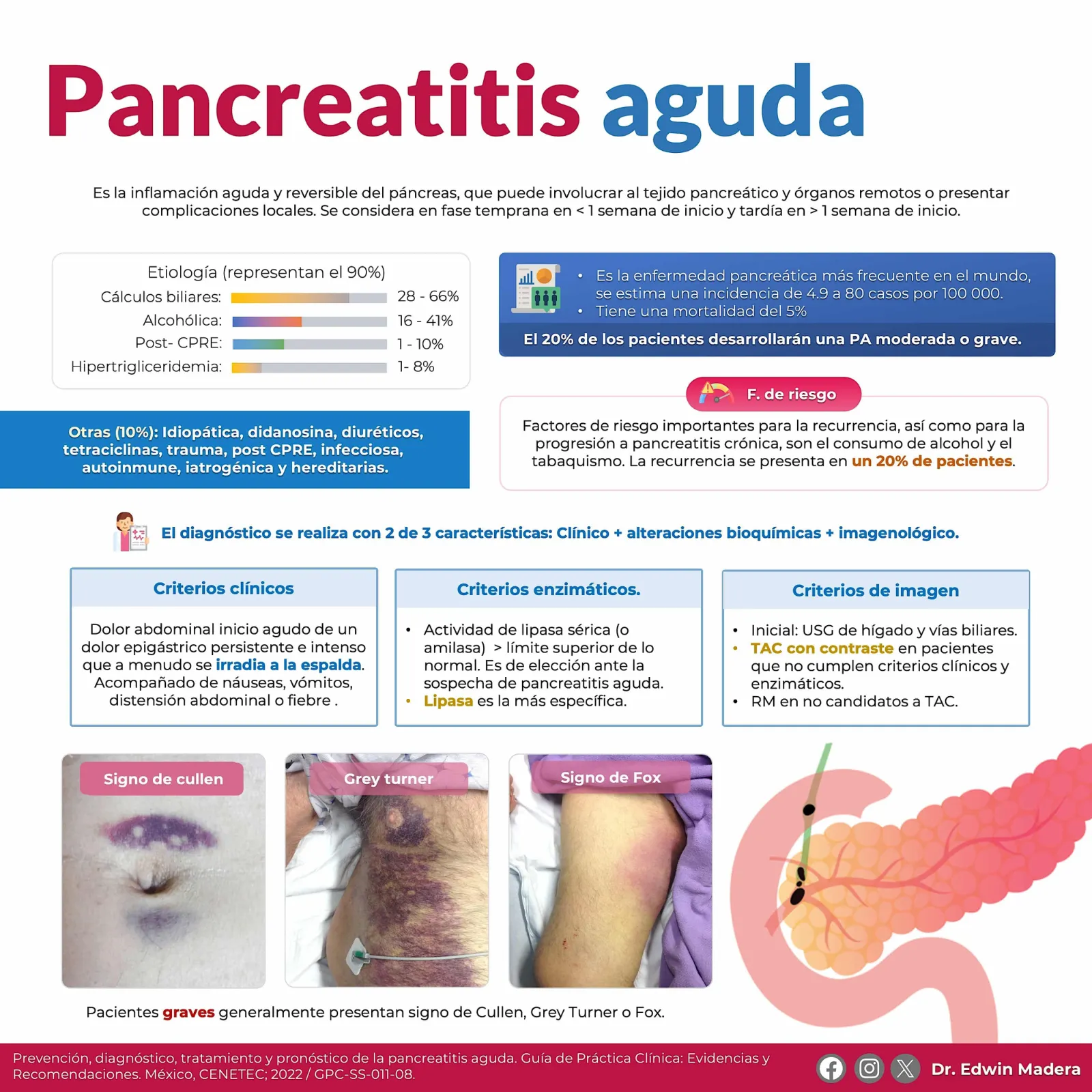 Pancreatitis aguda
