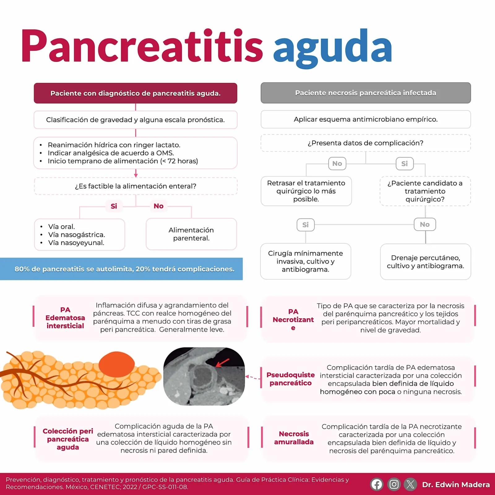 Pancreatitis aguda