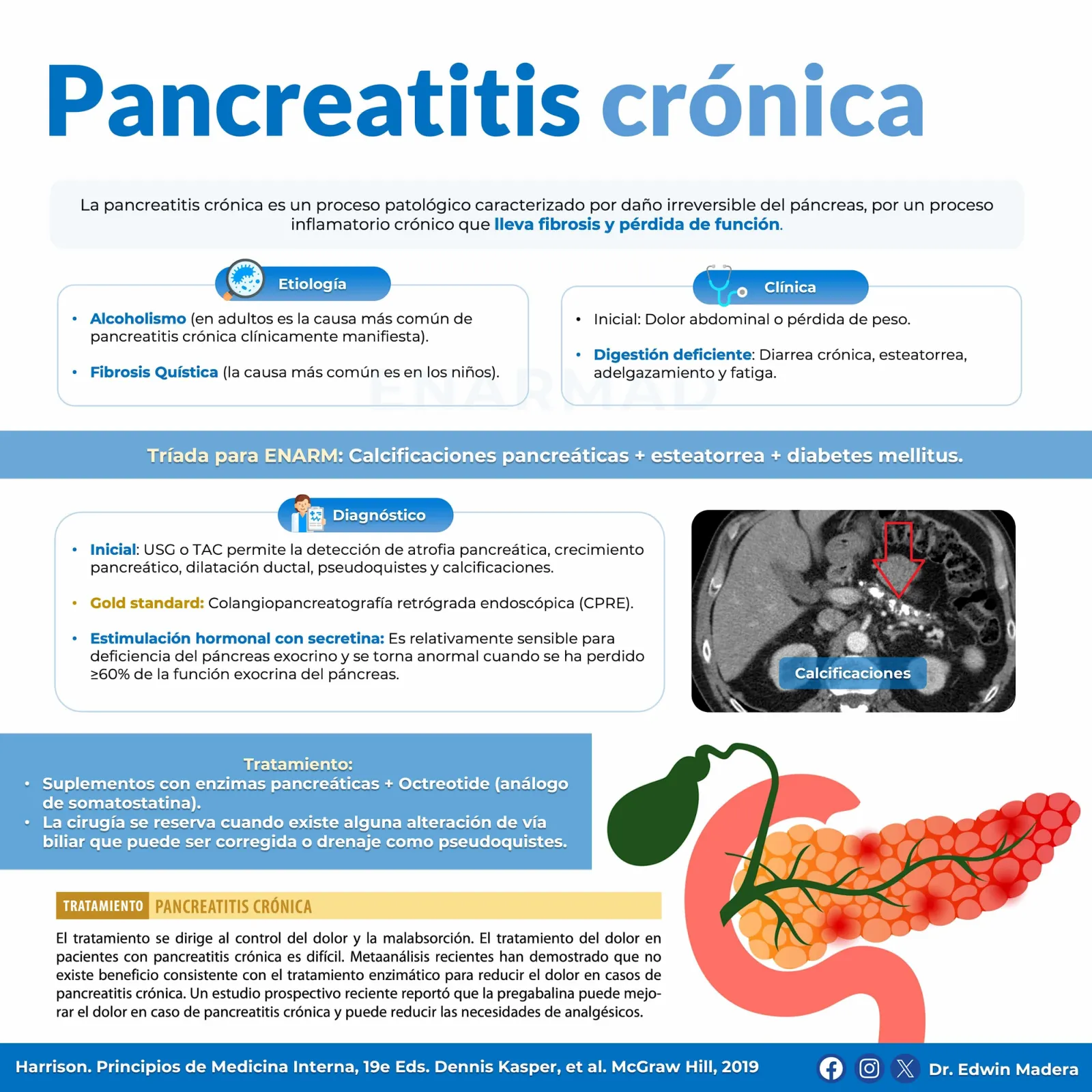 Pancreatitis crónica