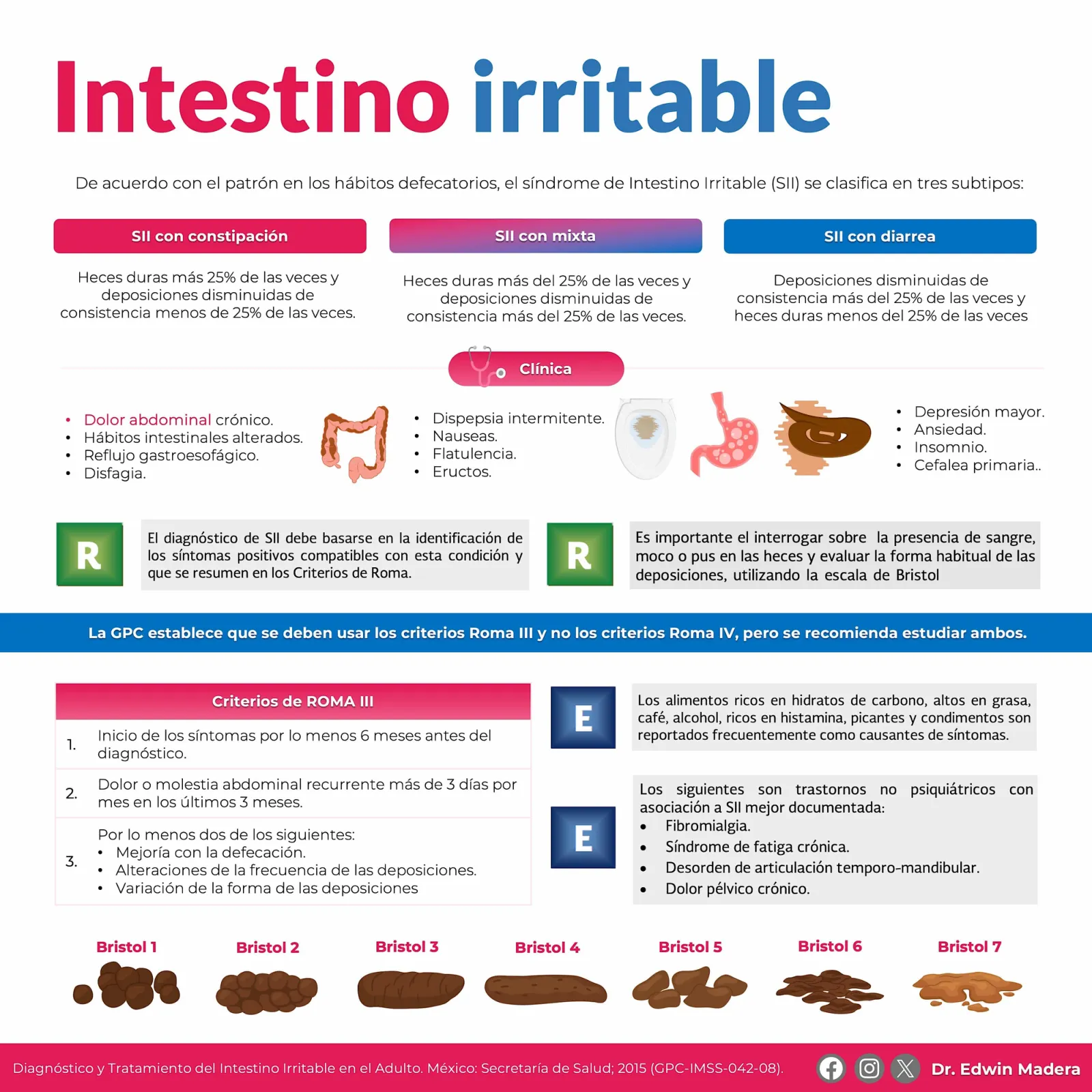 Síndrome de intestino irritable